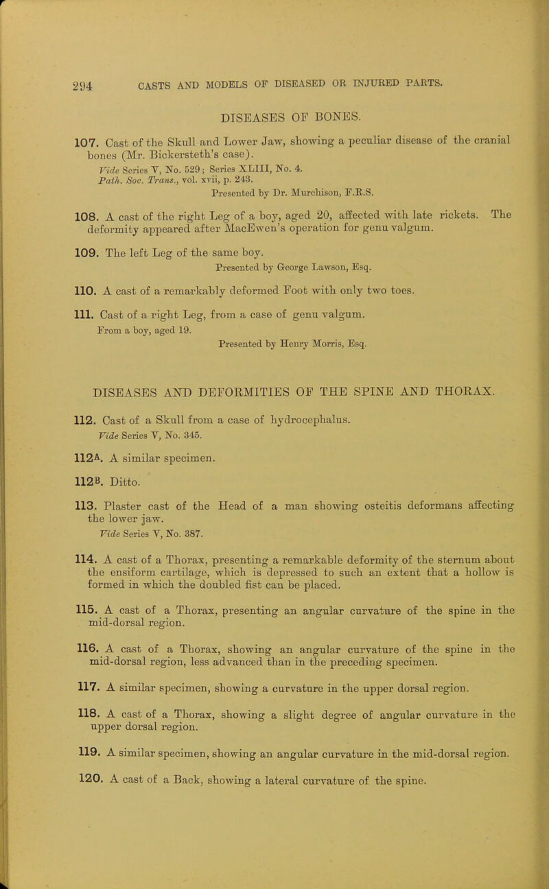 DISEASES OF BONES. 107. Cast of the Skull and Lower Jaw, showing a peculiar disease of the cranial bones (Mr. Bickersteth's case). Vide Series V, No. 529; Series XLIII, No. 4. PaiU. Soc. Trans., vol. xvii, p. 243. Presented by Dr. Mvu-chison, F.R.S. 108. A cast of the right Leg of a boy, aged 20, affected with late rickets. The deformity appeared after MacEwen's operation for genu valgum. 109. The left Leg of the same boy. Presented by George Lawson, Esq. 110. A cast of a remarkably deformed Foot with only two toes. 111. Cast of a right Leg, from a case of genu valgum. From a boy, aged 19. Presented by Henry Morris, Esq. DISEASES AND DEFOEMITIES OP THE SPINE AND THORAX. 112. Cast of a Skull from a case of hydrocephalus. Vide Series V, No. 345. 112^. A similar specimen. 112B. Ditto. 113. Plaster cast of the Head of a man showing osteitis deformans affecting the lower jaw. Vide Series V, No. 387. 114. A cast of a Thorax, presenting a remarkable deformity of the sternum about the ensiform cartilage, which is depressed to such an extent that a hollow is formed in which the doubled fist can be placed. 115. A cast of a Thorax, presenting an angular curvatiire of the spine in the mid-dorsal region. 116. A cast of a Thorax, showing an angular curvature of the spine in the mid-dorsal region, less advanced than in the preceding specimen. 117. A similar specimen, showing a curvature in the upper dorsal region. 118. A cast of a Thorax, showing a slight degree of angular curvature in the upper dorsal region. 119. A similar specimen, showing an angular curvature in the mid-dorsal region. 120. A cast of a Back, showing a lateral curvature of the spine.