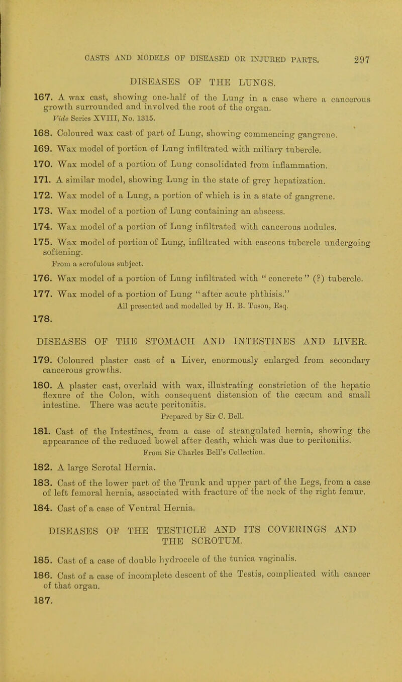 DISEASES OP THE LUNGS. 167. A wax cast, showing one-half of the Lung in a case where a cancerous growth surrounded and involved the root of the organ. Tide Series XVIII, No. 1315. 168. Coloured wax cast of part of Lung, showing commencing gangrene. 169. Wax model of portion of Lung infiltrated with miliary tubercle. 170. Wax model of a portion of Lung consolidated from inflammation. 171. A similar model, showing Lung in the state of grey hepatization. 172. Wax model of a Lung, a portion of which, is in a state of gangrene. 173. Wax model of a portion of Lung containing an abscess. 174. Wax model of a portion of Lung infiltrated witb cancerous nodules. 175. Wax model of portion of Lung, infiltrated with caseous tubercle undergoing softening. Fi'om a scrofulous subject. 176. Wax model of a portion of Lung infiltrated with.  concrete  (?) tubercle. 177. Wax model of a portion of Lung  after acute phthisis. All presented and modelled by H. B. Tuson, Esq. 178. DISEASES OF THE STOMACH AKD INTESTINES AND LIYER. 179. Coloured plaster cast of a Liver, enormously enlarged from secondary cancerous growths. 180. A plaster cast, overlaid with wax, illustrating constriction of the hepatic flexure of the Colon, with, consequent distension of the caecum and small intestine. There was acute peritonitis. Prepared by Sir C. Bell. 181. Cast of the Intestines, from a case of strangulated hernia, showing the appearance of th.e reduced bowel after death, which was due to peritonitis. From Sir Charles Bell's Collection. 182. A large Scrotal Hernia. 183. Cast of the lower part of the Trunk and upper part of the Legs, from a case of left femoral hernia, associated with fracture of the neck of the right femur. 184. Cast of a case of Ventral Hernia. DISEASES OF THE TESTICLE AND ITS COVERINGS AND THE SCROTUM. 185. Cast of a case of doable hydrocele of the tunica vaginalis. 186. Cast of a case of incomplete descent of the Testis, complicated with cancer of that organ. 187.