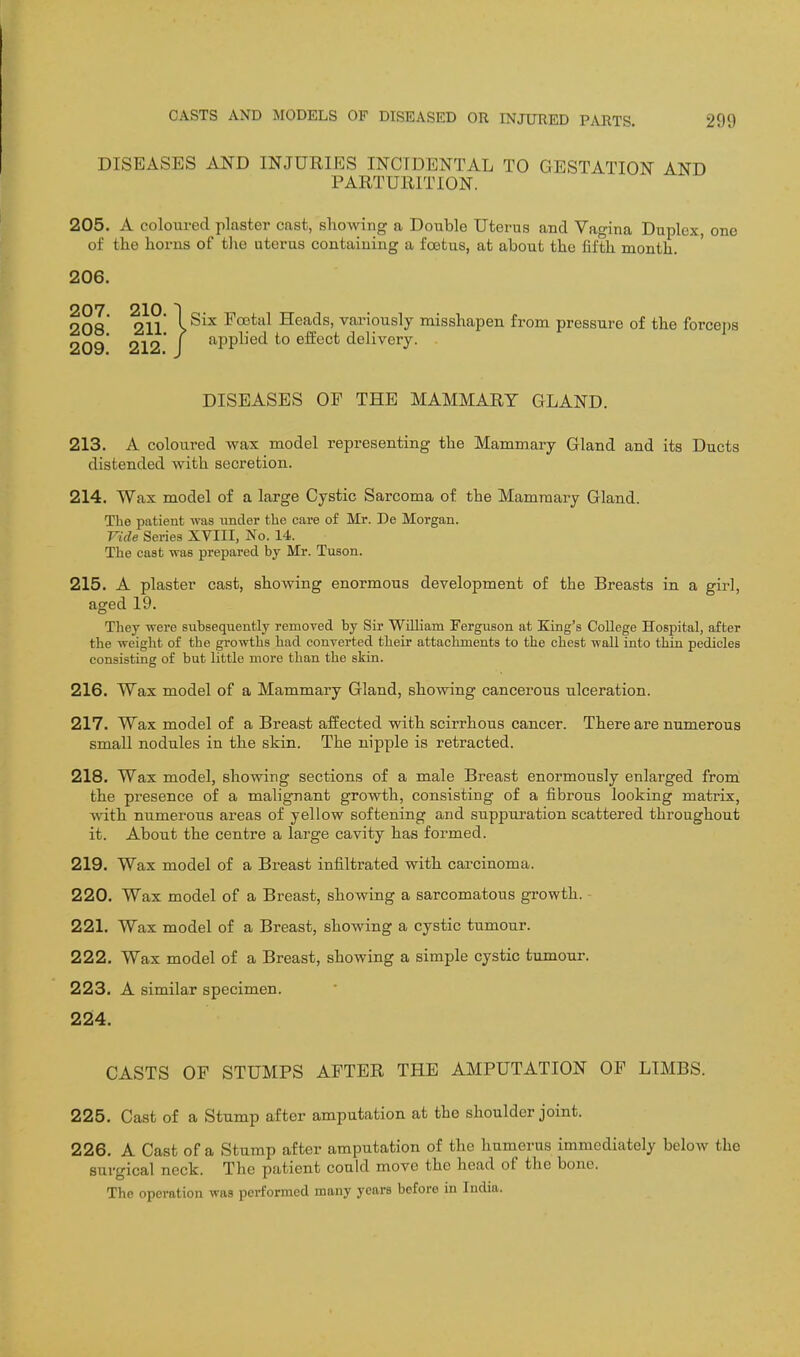 DISEASES AND INJURIES INCIDENTAL TO GESTATION AND PARTURITION. 205. A coloured plaster cast, showing a Double Uterus and Vagina Duplex, one of the horns of the uterus containing a foetus, at about the fifth month. 206. 207 210 1 208* 21l >^^^ Foetal Heads, vainously misshapen from pressure of the forcejjs 209* 212* f ^PP^^^*^ effect delivery. DISEASES OE THE MAMMARY GLAND. 213. A coloured wax model representing the Mammary Gland and its Ducts distended with secretion. 214. Wax model of a large Cystic Sarcoma of the Mammary Gland. The patient Tvas under the care of Mr. De Morgan. Vide Series XVIII, No. 14. The cast was prepared by Mr. Tuson. 215. A plaster cast, showing enormous development of the Breasts in a girl, aged 19. They were subsequently removed by Sir William Ferguson at King's College Hospital, after the weight of the growths had converted their attachments to the chest wall into thin pedicles consisting of but little more than the skin. 216. Wax model of a Mammary Gland, showing cancerous ulceration. 217. Wax model of a Breast affected with scirrhous cancer. There are numerous small nodules in the skin. The nipple is retracted. 218. Wax model, showing sections of a male Breast enormously enlarged from the presence of a malignant growth, consisting of a fibrous looking matrix, with numerous areas of yellow softening and suppui'ation scattered throughout it. About the centre a large cavity has formed. 219. Wax model of a Breast infiltrated with carcinoma. 220. Wax model of a Breast, showing a sarcomatous growth. - 221. Wax model of a Breast, showing a cystic tumour. 222. Wax model of a Breast, showing a simple cystic tumour. 223. A similar specimen. 224. CASTS OF STUMPS AFTER THE AMPUTATION OF LIMBS. 225. Cast of a Stump after amputation at the shoulder joint. 226. A Cast of a Stump after amputation of the humerus immediately below the surgical neck. The patient could move the head of the bone. The operation was performed many years before in India.