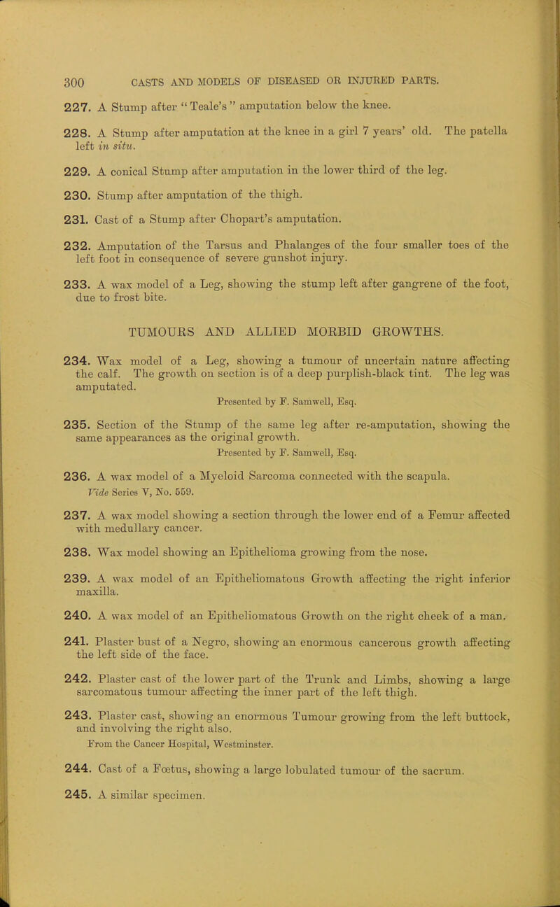 227. A Stump after  Teale's  amputation below tlie knee. 228. A Stump after amputation at the knee in a girl 7 years' old. The patella left in situ. 229. A conical Stump after amputation in the lower third of the leg. 230. Stump after amputation of the thigh. 231. Cast of a Stump after Chopart's amputation. 232. Amputation of the Tarsus and Phalanges of the four smaller toes of the left foot in consequence of severe gunshot injury. 233. A wax model of a Leg, showing the stump left after gangrene of the foot, due to frost bite. TUMOURS AND ALLIED MORBID GROWTHS. 234. Wax model of a Leg, showing a tumour of uncertain nature aflPecting the calf. The growth on section is of a deep purplish-black tint. The leg was amputated. Presented by F. SamweU, Esq. 235. Section of the Stump of the same leg after re-amputation, showing the same appearances as the original growth. Presented by P. SamweU, Esq. 236. A wax model of a Myeloid Sarcoma connected with the scapula. Vide Series V, No. 559. 237. A wax model showing a section through the lower end of a Femui- affected with medullary cancer. 238. Wax model showing an Epithelioma growing from the nose. 239. A wax model of an Epitheliomatous Growth affecting the right inferior maxilla. 240. A wax model of an Epitheliomatous Growth on the right cheek of a man. 241. Plaster bust of a Negro, showing an enormous cancerous growth affecting the left side of the face. 242. Plaster cast of the lower part of the Trunk and Limbs, showing a lai'ge sarcomatous tumour affecting the inner part of the left thigh. 243. Plaster cast, showing an enormous Tumour growing from the left buttock, and involving the right also. From the Cancer Hospital, Westminster. 244. Cast of a Poetus, showing a large lobulated tumoui- of the sacrum. 245. A similar specimen.