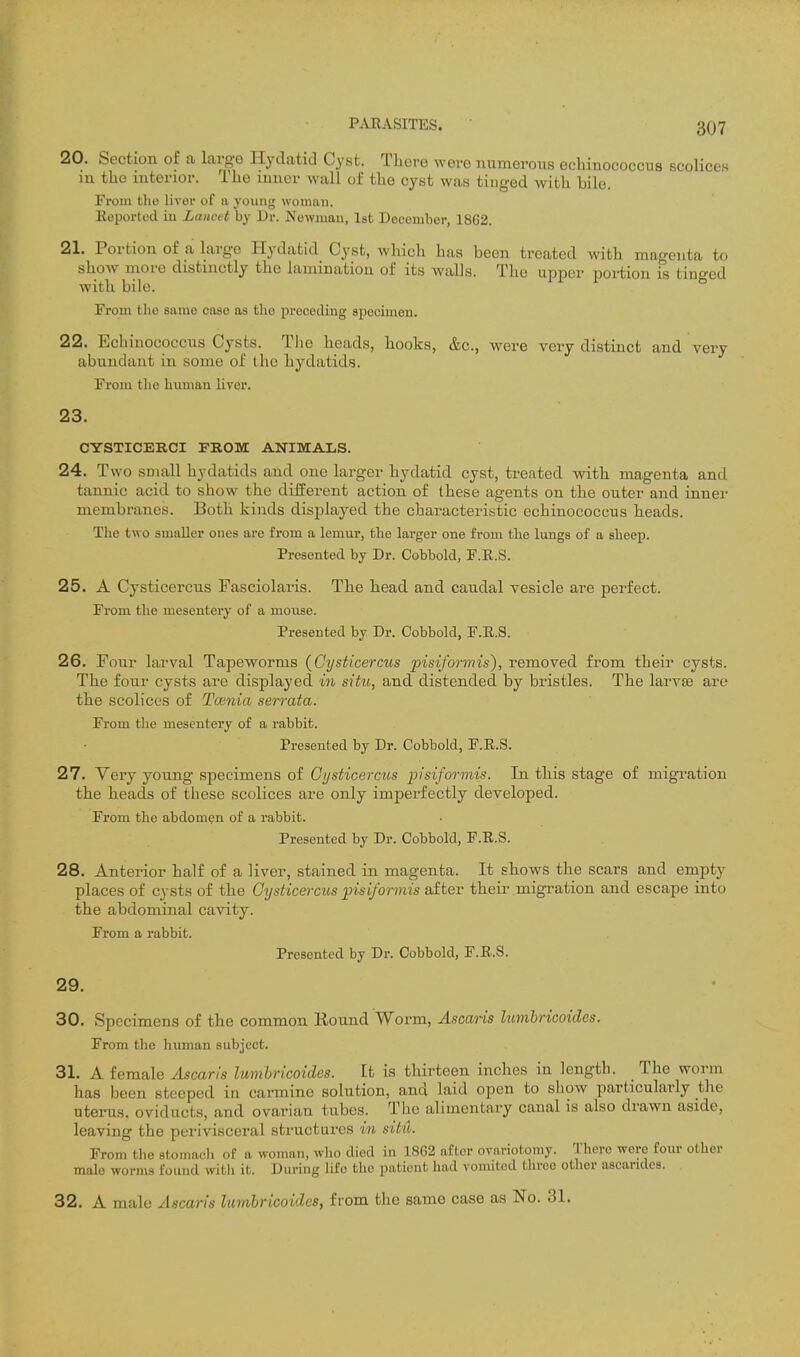 20. Section of a large Hydatid Cyst. There were numerous echinococcus scolices lu the interior. The inner wall of the cyst was tinged with bile. From the liver of ii young woman. Keported in Lancet by Dr. Newmau, Ist December, 1862. 21. Portion of a large Hydatid Cyst, which has been treated with magenta to show niore distinctly the lamination of its walls. The upper portion is tinged with bile. From the same case as the preceding apecimen. 22. Echinococcus Cysts. The heads, hooks, &c., were very distinct and very abundant in some of the hydatids. Fi'om the human liver. 23. CYSTICERCI FROM ANIMALS. 24. Two SDuiU hydatids and one larger hydatid cyst, treated with magenta and tannic acid to show the different action of these agents on the outer and inner membranes. Both kinds displayed the characteristic echinococcus heads. The two smaller ones are from a lemur, the larger one from the lungs of a sheep. Presented by Dr. Cobbold, F.E.S. 25. A Cysticercus Fasciolaris. The head and caudal vesicle are perfect. From the mesentery of a mouse. Presented by Dr. Cobbold, F.E.S. 26. Four larval Tapeworms {Cysticercus pisiformis), removed from their cysts. The four cysts are displayed in situ, and distended by bristles. The larvte are the scolices of Tcenia serrata. From tlie mesentery of a rabbit. Presented by Dr. Cobbold, F.E.S. 27. Very young specimens of Gi/sticercus pisiformis. In this stage of migration the heads of these scolices are only imperfectly developed. From the abdomen of a rabbit. Presented by Dr. Cobbold, F.E.S. 28. Anterior half of a liver, stained in magenta. It shows the scars and empty places of cysts of the Gysticeixus pisiformis alter theii\migration and escape into the abdominal cavity. From a rabbit. Presented by Dr. Cobbold, F.E.S. 29. 30. Specimens of the common Kound Worm, Ascaris lumhricoides. From the human subject. 31. A female Ascaris lumhricoides. It is thirteen inches in length. The worm has been steeped in carmine solution, and laid open to show particularly the uterus, oviducts, and ovarian tubes. The alimentary canal is also drawn aside, leaving the perivisceral structures in situ. From the stoniacli of a woman, who died in 1862 after ovariotomy. There were fom- other male worms found with it. During life the patient had vomited three other ascarides. 32. A male Ascaris lumhricoides, from the same case as No. 31.