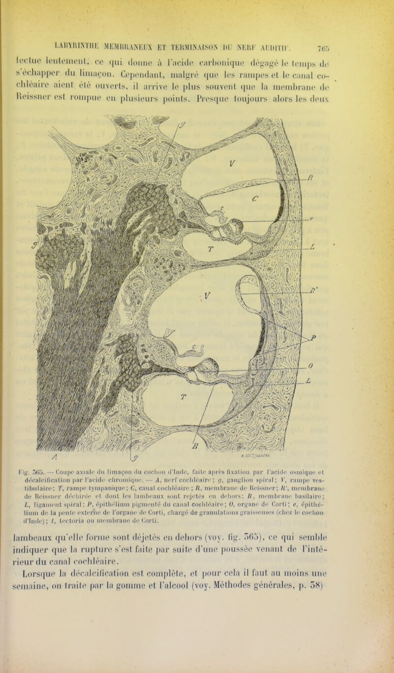 l.AliYlUNTIlK MEMWKANKliX ET TEHiMlNAISON NEHF Alil)lTII\ 7or, loclup lenloiiUMiL ce (jui (\o\\nv ;t \';\c'u\c (•arhoiiuiue dégagé le Iciiips de s èchap|HM' (lu liiiiacdii. CcpiMidaiil, malgré (|Uo los rampes et le canal cd- chléaire aioni élé ouvcrls. il airive le plus soiivcnl (pie la membrane de lUMSsner est rompue en |)lusieurs points. IVesipie loujours alors les deux 3()o. — eoiipo axiair du lima(;on ilu cochon d'iiidi', l'aile a|ir('s lixalion par l'acide osiiiiqin^ (d décalcilicatioii par l'acide (:lin)rrii(|ue. — /l, iierl'cocliiéaire ; g, fîaiii;li()M spiral; V, ratiip(^ ves- lihiilairc; 7', rampe tympaiiicjue: (',. canal cocliléaire ; It, menibratie de lleisstier; /(', rneinbraiie de Ueissiier déeliirOe et doiil les lambeaux sent rejelés en dehors: 11, inemhraiie hasilaire; L, lifçameiit s|)iral : P, épitlK'liuiri |)igmeiité du canal cocliléairo; 0, orf,Mne de Corli; e, 6[t\lh6- liiim de la pente externe de l'organe de (lorti, charf,'ô de i^'rannlalions ^'raissonses (chez le cochon d'Inde); /, tectoria on miMiihrane de Corli. lambeaux qir(>lle forme sont (h'jelés en dehors (voy. lig. 7A)o), ce qui semble indiquer (|ue la ruplure s'est faite par suite d'une poussée venant de l'inté- rieur du canal cochléaire. Lors([ue la décalcilication est complète, et pour cela il faut an moins une semaine, on traite par la gomme et l'alcool (voy. Méthodes générales, p. 5S)