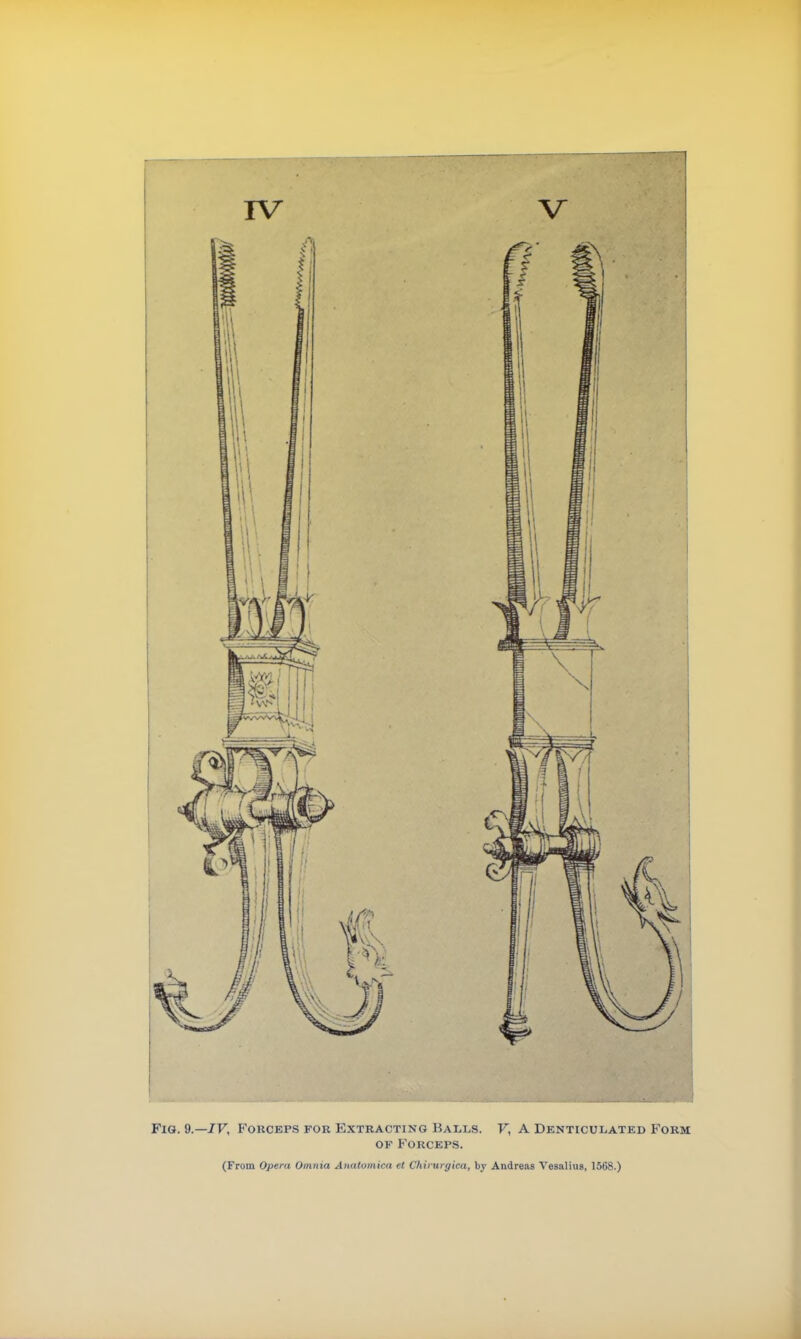 Fig. 9.—IV, Forceps for Extracting Balls. V, A Denticulated Form of Forceps. (From Opera Omnia Anatomica et Chinugica, by Andreas Vesalius, 1568.)