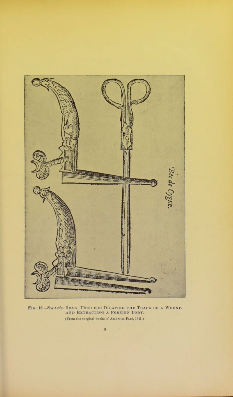 Fig. 16.—Swan's Hear, Used for Dilating the Track of a Wound and Extracting a Foreign Body. (From the surgical works of Ambroise Pare, 1641.)