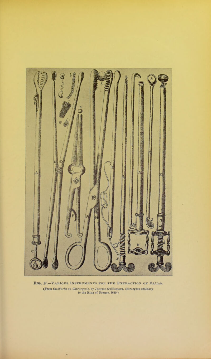 Fig. 17.—Various Instruments for tiif, Extraction of Balus. (From theWorka on Chirurijerie, by Jacques Guillemeau. chirurgeon ordinary