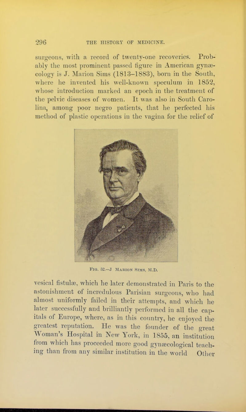 surgeons, with a record of twenty-one recoveries. Prob- ably the most prominent passed figure in American gyne- cology is J. Marion Sims (1813-1883), born in the South, where he invented his well-known speculum in 1852, whose introduction marked an epoch in the treatment of the pelvic diseases of women. It was also in South Caro- lina, among poor negro patients, that he perfected his method of plastic operations in the vagina for the relief of Fig. 52.—J Marion .Sims, M.d. vesical fistulas, which he later demonstrated in Paris to the astonishment of incredulous Parisian surgeons, who had almost uniformly failed in their attempts, and which he later successfully and brilliantly performed in all the cap- itals of Europe, where, as in this country, he enjoyed the greatest reputation. He was the founder of the great Woman's Hospital in New York, in 1855, an institution from which has proceeded more good gynecological teach- ing than from any similar institution in the world Other