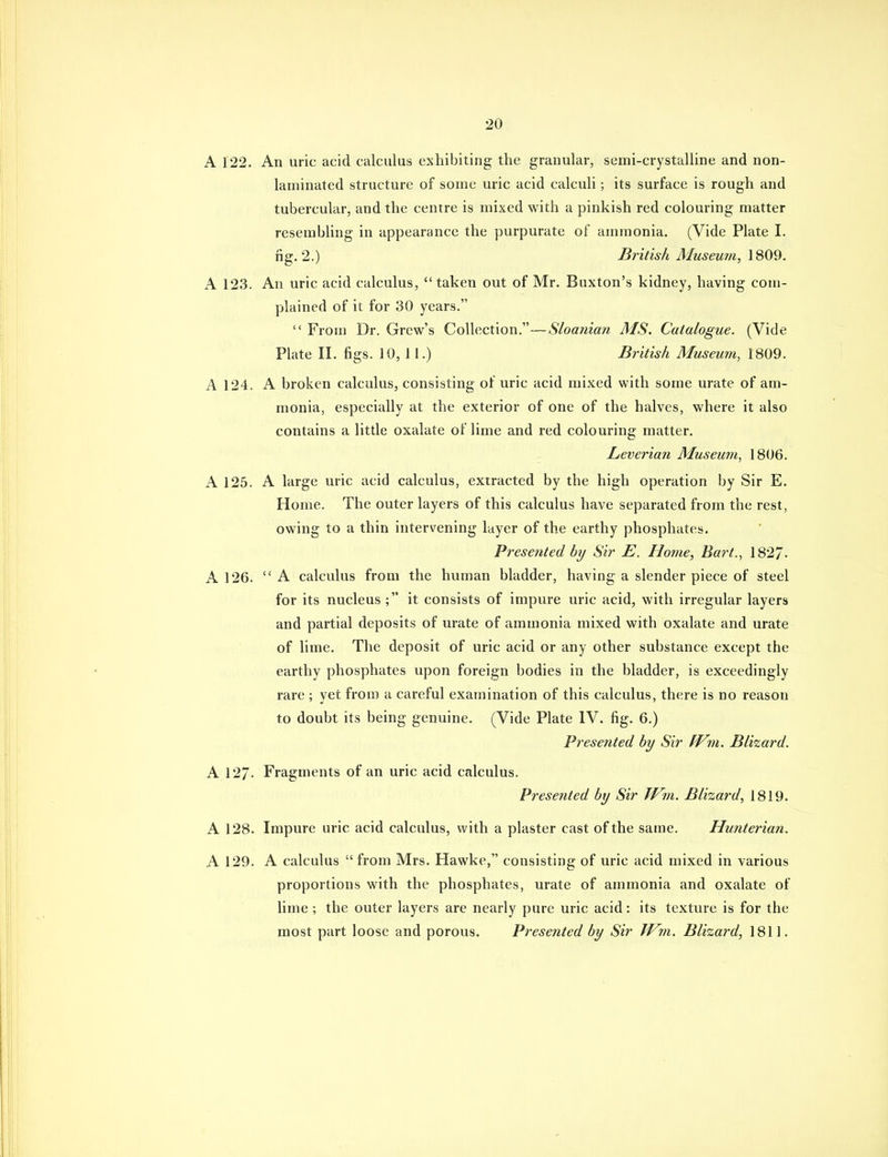A 122. An uric acid calculus exhibiting the granular, semi-crystalline and non- laminated structure of some uric acid calculi; its surface is rough and tubercular, and the centre is mixed with a pinkish red colouring matter resembling in appearance the purpurate of ammonia. (Vide Plate I. fig. 2.) British Museum, 1809. A 123. An uric acid calculus, taken out of Mr. Buxton's kidney, having com- plained of it for 30 years. From Dr. Grew's Collection,—Sloanian MS. Catalogue. (Vide Plate II. figs. 10, 11.) British Museum, 1809. A 124. A broken calculus, consisting of uric acid mixed with some urate of am- monia, especially at the exterior of one of the halves, where it also contains a little oxalate of lime and red colouring matter. Leverian Museum, 1806. A 125. A large uric acid calculus, extracted by the high operation by Sir E. Home. The outer layers of this calculus have separated from the rest, owing to a thin intervening layer of the earthy phosphates. Presented hy Sir E. Home, Bart., 1827- A 126. A calculus from the human bladder, having a slender piece of steel for its nucleus ; it consists of impure uric acid, with irregular layers and partial deposits of urate of ammonia mixed with oxalate and urate of lime. The deposit of uric acid or any other substance except the earthy phosphates upon foreign bodies in the bladder, is exceedingly rare ; yet from a careful examination of this calculus, there is no reason to doubt its being genuine. (Vide Plate IV. fig. 6.) Presented by Sir U^m. Blizard. A 12/. Fragments of an uric acid calculus. Presented by Sir TVm. Blizard, 1819. A 128. Impure uric acid calculus, with a plaster cast of the same. Hunterian. A 129. A calculus from Mrs. Hawke, consisting of uric acid mixed in various proportions with the phosphates, urate of ammonia and oxalate of lime ; the outer layers are nearly pure uric acid: its texture is for the most part loose and porous. Presented by Sir IVm. Blizard, 1811.