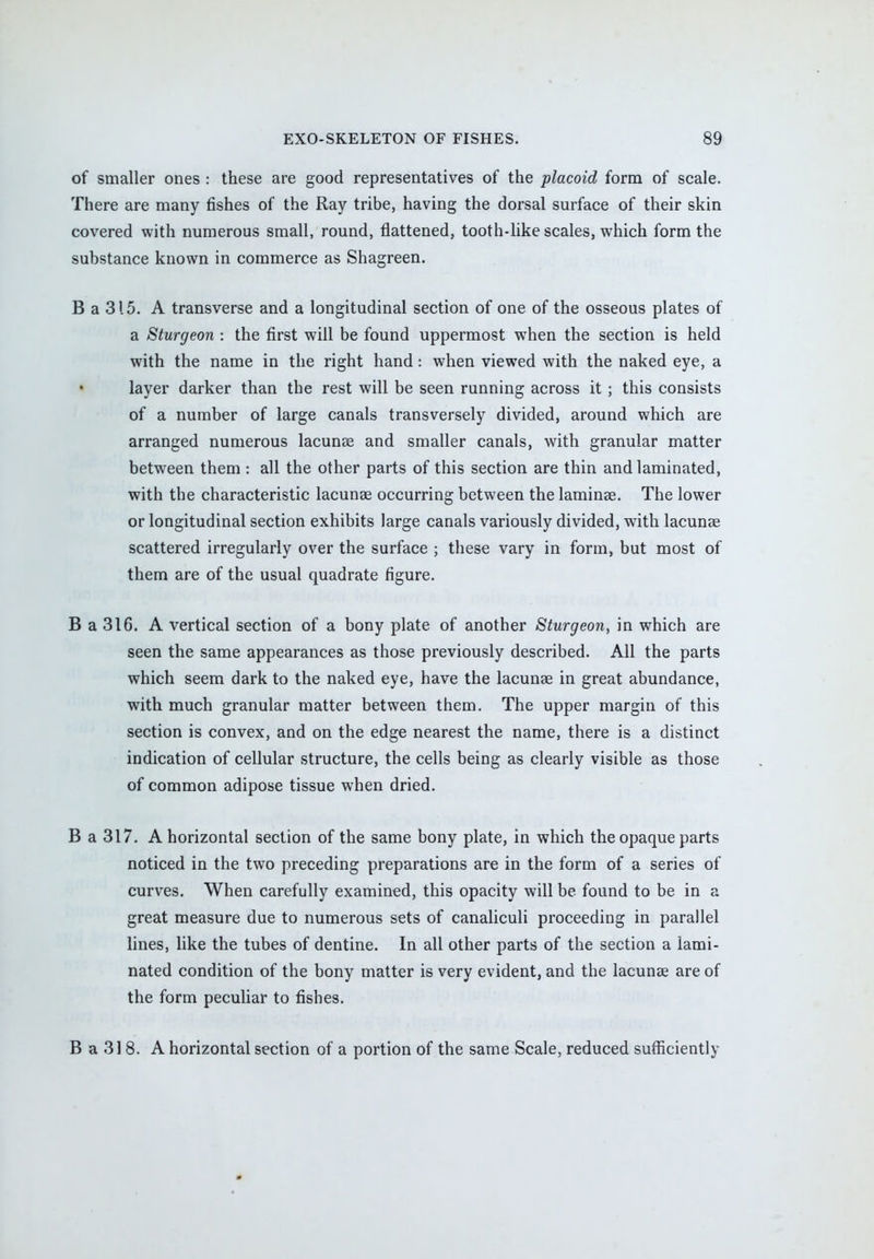 of smaller ones : these are good representatives of the placoid form of scale. There are many fishes of the Ray tribe, having the dorsal surface of their skin covered with numerous small, round, flattened, tooth-like scales, which form the substance known in commerce as Shagreen. B a 315. A transverse and a longitudinal section of one of the osseous plates of a Sturgeon : the first will be found uppermost when the section is held with the name in the right hand: when viewed with the naked eye, a layer darker than the rest will be seen running across it ; this consists of a number of large canals transversely divided, around which are arranged numerous lacunae and smaller canals, with granular matter between them : all the other parts of this section are thin and laminated, with the characteristic lacuna? occurring between the laminae. The lower or longitudinal section exhibits large canals variously divided, with lacunae scattered irregularly over the surface ; these vary in form, but most of them are of the usual quadrate figure. B a 316. A vertical section of a bony plate of another Sturgeon, in which are seen the same appearances as those previously described. All the parts which seem dark to the naked eye, have the lacunae in great abundance, with much granular matter between them. The upper margin of this section is convex, and on the edge nearest the name, there is a distinct indication of cellular structure, the cells being as clearly visible as those of common adipose tissue when dried. B a 317. A horizontal section of the same bony plate, in which the opaque parts noticed in the two preceding preparations are in the form of a series of curves. When carefully examined, this opacity will be found to be in a great measure due to numerous sets of canaliculi proceeding in parallel lines, like the tubes of dentine. In all other parts of the section a lami- nated condition of the bony matter is very evident, and the lacunae are of the form peculiar to fishes. B a 318. A horizontal section of a portion of the same Scale, reduced sufficiently
