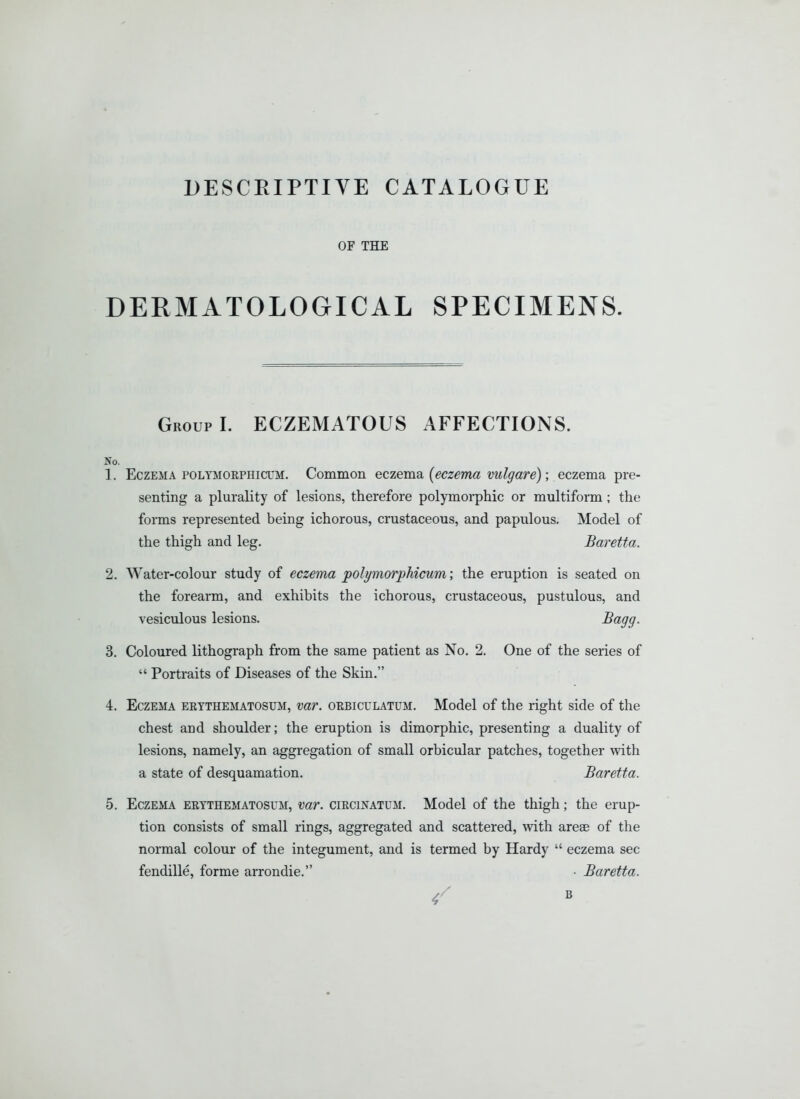 DESCEIPTIYE CATALOGUE OF TKE DERMATOLOGICAL SPECIMENS. Group I. ECZEMATOUS AFFECTIONS. No. 1. Eczema poltmoephicum. Common eczema {eczema vulgare); eczema pre- senting a plurality of lesions, therefore polymorphic or multiform; the forms represented being ichorous, crustaceous, and papulous. Model of the thigh and leg. Baretta. 2. Water-colour study of eczema polymorphicum; the eruption is seated on the forearm, and exhibits the ichorous, crustaceous, pustulous, and vesiculous lesions. ^^199- 3. Coloured lithograph from the same patient as No. 2. One of the series of  Portraits of Diseases of the Skin. 4. Eczema eeythematosum, var. okbiculatum. Model of the right side of the chest and shoulder; the eruption is dimorphic, presenting a duality of lesions, namely, an aggregation of small orbicular patches, together with a state of desquamation. Baretta. 5. Eczema ertthematosum, var. circinatum. Model of the thigh; the erup- tion consists of small rings, aggregated and scattered, with arese of the normal colour of the integument, and is termed by Hardy  eczema sec fendille, forme arrondie. ■ Baretta.