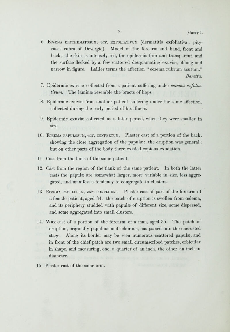 6. Eczema erythematosum, mr. exfoliativum (dermatitis exfoliativa; pity- riasis rubra of Devergie). Model of the forearm and hand, front and back; the skin is intensely red, the epidermis thin and transparent, and the surface flecked by a few scattered desquamating exuviae, oblong and narrow in figure. Lailler terms the affection  eczema rubrum acutum. Baretta. 7. Epidermic exuviae collected from a patient suffering under eczema exfolia- tivum. The laminae resemble the bracts of hops. 8. Epidermic exuviae from another patient suffering under the same affection, collected during the early period of his illness. 9. Epidermic exuviae collected at a later period, when they were smaller in size, 10. Eczema papulosum, mr. confertum. Plaster cast of a portion of the back, showdng the close aggregation of the papulae ; the eruption was general; but on other parts of the body there existed copious exudation. 11. Cast from the loins of the same patient. 12. Cast from the region of the flank of the same patient. In both the latter casts the papulae are somewhat larger, more variable in size, less aggre- gated, and manifest a tendency to congregate in clusters. 13. Eczema papulosum, var. conpluens. Plaster cast of part of the forearm of a female patient, aged 34: the patch of eruption is swollen from oedema, and its periphery studded with papulae of different size, some dispersed, and some aggregated into small clusters. 14. Wax cast of a portion of the forearm of a man, aged 35. The patch of eruption, originally papulous and ichorous, has passed into the encrusted stage. Along its border may be seen numerous scattered papulae, and in front of the chief patch are two small circumscribed patches, orbicular in shape, and measuring, one, a quarter of an inch, the other an inch in diameter. 15. Plaster cast of the same arm.