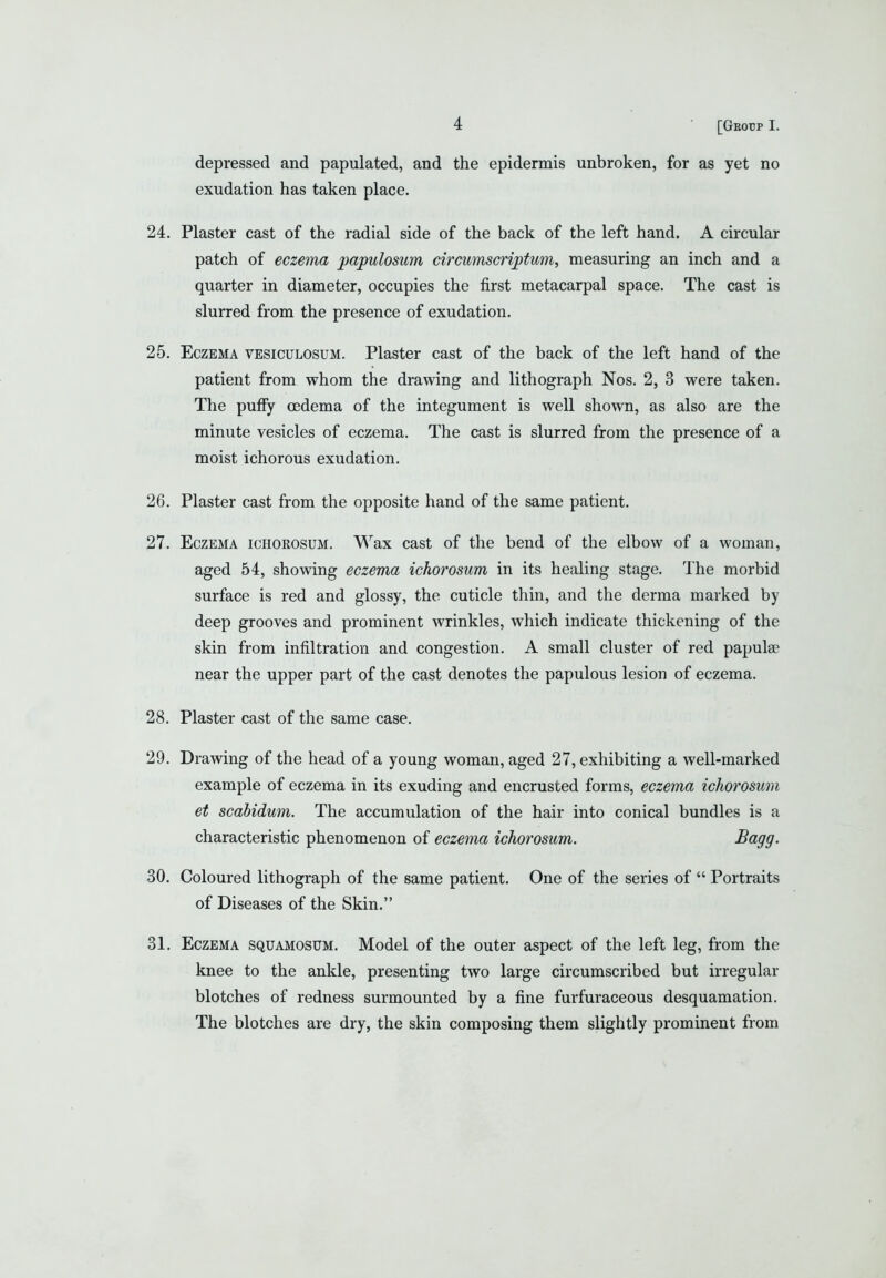 depressed and papulated, and the epidermis unbroken, for as yet no exudation has taken place. 24. Plaster cast of the radial side of the back of the left hand. A circular patch of eczema papulosum circumscriptum, measuring an inch and a quarter in diameter, occupies the first metacarpal space. The cast is slurred from the presence of exudation. 25. Eczema vesiculosum. Plaster cast of the back of the left hand of the patient from whom the drawing and lithograph Nos. 2, 3 were taken. The puffy cedema of the integument is well shown, as also are the minute vesicles of eczema. The cast is slurred from the presence of a moist ichorous exudation. 26. Plaster cast from the opposite hand of the same patient. 27. Eczema ichorosum. Wax cast of the bend of the elbow of a woman, aged 54, showing eczema ichorosum in its healing stage. The morbid surface is red and glossy, the cuticle thin, and the derma marked by deep grooves and prominent wrinkles, which indicate thickening of the skin from infiltration and congestion. A small cluster of red papulae near the upper part of the cast denotes the papulous lesion of eczema. 28. Plaster cast of the same case. 29. Drawing of the head of a young woman, aged 27, exhibiting a well-marked example of eczema in its exuding and encrusted forms, eczema ichorosum et scabidum. The accumulation of the hair into conical bundles is a characteristic phenomenon of eczema ichorosum. ^(^99- 30. Coloured lithograph of the same patient. One of the series of  Portraits of Diseases of the Skin. 31. Eczema squamosum. Model of the outer aspect of the left leg, from the knee to the ankle, presenting two large circumscribed but irregular blotches of redness surmounted by a fine furfuraceous desquamation. The blotches are dry, the skin composing them slightly prominent from