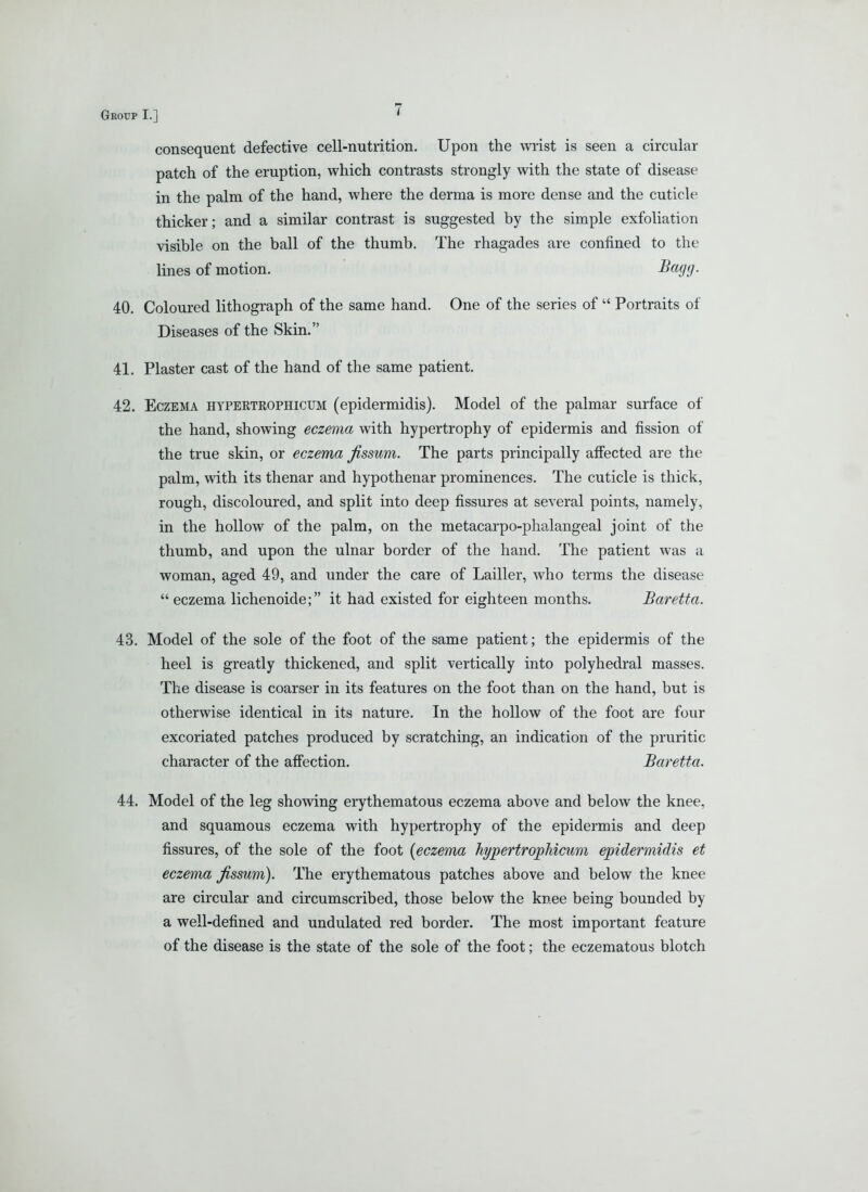 consequent defective cell-nutrition. Upon the m-ist is seen a circular patch of the eruption, which contrasts strongly with the state of disease in the palm of the hand, where the derma is more dense and the cuticle thicker; and a similar contrast is suggested by the simple exfoliation visible on the ball of the thumb. The rhagades are confined to the lines of motion. -S«5'!7- 40. Coloured lithograph of the same hand. One of the series of  Portraits of Diseases of the Skin. 41. Plaster cast of the hand of the same patient. 42. Eczema hyperteophicum (epidermidis). Model of the palmar surface of the hand, showing eczema with hypertrophy of epidermis and fission of the true skin, or eczema Jissum. The parts principally afiected are the palm, with its thenar and hypothenar prominences. The cuticle is thick, rough, discoloured, and split into deep fissures at several points, namely, in the hollow of the palm, on the metacarpo-phalangeal joint of the thumb, and upon the ulnar border of the hand. The patient was a woman, aged 49, and under the care of Lailler, Avho terms the disease  eczema lichenoide; it had existed for eighteen months. Baretta. 43. Model of the sole of the foot of the same patient; the epidermis of the heel is greatly thickened, and split vertically into polyhedral masses. The disease is coarser in its features on the foot than on the hand, but is otherwise identical in its nature. In the hollow of the foot are four excoriated patches produced by scratching, an indication of the pruritic character of the afi'ection. Baretta. 44. Model of the leg showing erythematous eczema above and below the knee, and squamous eczema with hypertrophy of the epidermis and deep fissures, of the sole of the foot [eczema hypertropMcum epidermidis et eczema Jissum). The erythematous patches above and below the knee are circular and circumscribed, those below the knee being bounded by a well-defined and undulated red border. The most important feature of the disease is the state of the sole of the foot; the eczematous blotch