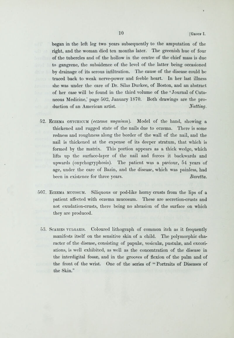 « 10 [Geoup I. began in the left leg two years subsequently to the amputation of the right, and the woman died ten months later. The greenish hue of four of the tubercles and of the hollow in the centre of the chief mass is due to gangrene, the subsidence of the level of the latter being occasioned by drainage of its serous infiltration. The cause of the disease could be traced back to weak nerve-power and feeble heart. In her last illness she was under the care of Dr. Silas Durkee, of Boston, and an abstract of her case will be found in the third volume of the ' Journal of Cuta- neous Medicine,' page 502, January 1870. Both drawings are the pro- duction of an American artist. Nutting. 52. Eczema onychicum {eczema unguium). Model of the hand, showing a thickened and rugged state of the nails due to eczema. There is some redness and roughness along the border of the wall of the nail, and the nail is thickened at the expense of its deeper stratum, that which is formed by the matrix. This portion appears as a thick wedge, which lifts up the surface-layer of the nail and forces it backwards and upwards (onychogryphosis). The patient was a paviour, 54 years of age, under the care of Bazin, and the disease, which was painless, had been in existence for three years. Baretta. 507. Eczema mucosum. Siliquous or pod-like horny crusts from the lips of a patient affected with eczema mucosum. These are secretion-crusts and not exudation-crusts, there being no abrasion of the surface on which they are produced. 53. Scabies vulgaris. Coloured lithograph of common itch as it frequently manifests itself on the sensitive skin of a child. The polymorphic cha- racter of the disease, consisting of papulae, vesiculae, pustulse, and excori- ations, is well exhibited, as well as the concentration of the disease in the interdigital fossae, and in the grooves of flexion of the palm and of the front of the wrist. One of the series of Portraits of Diseases of the Skin.