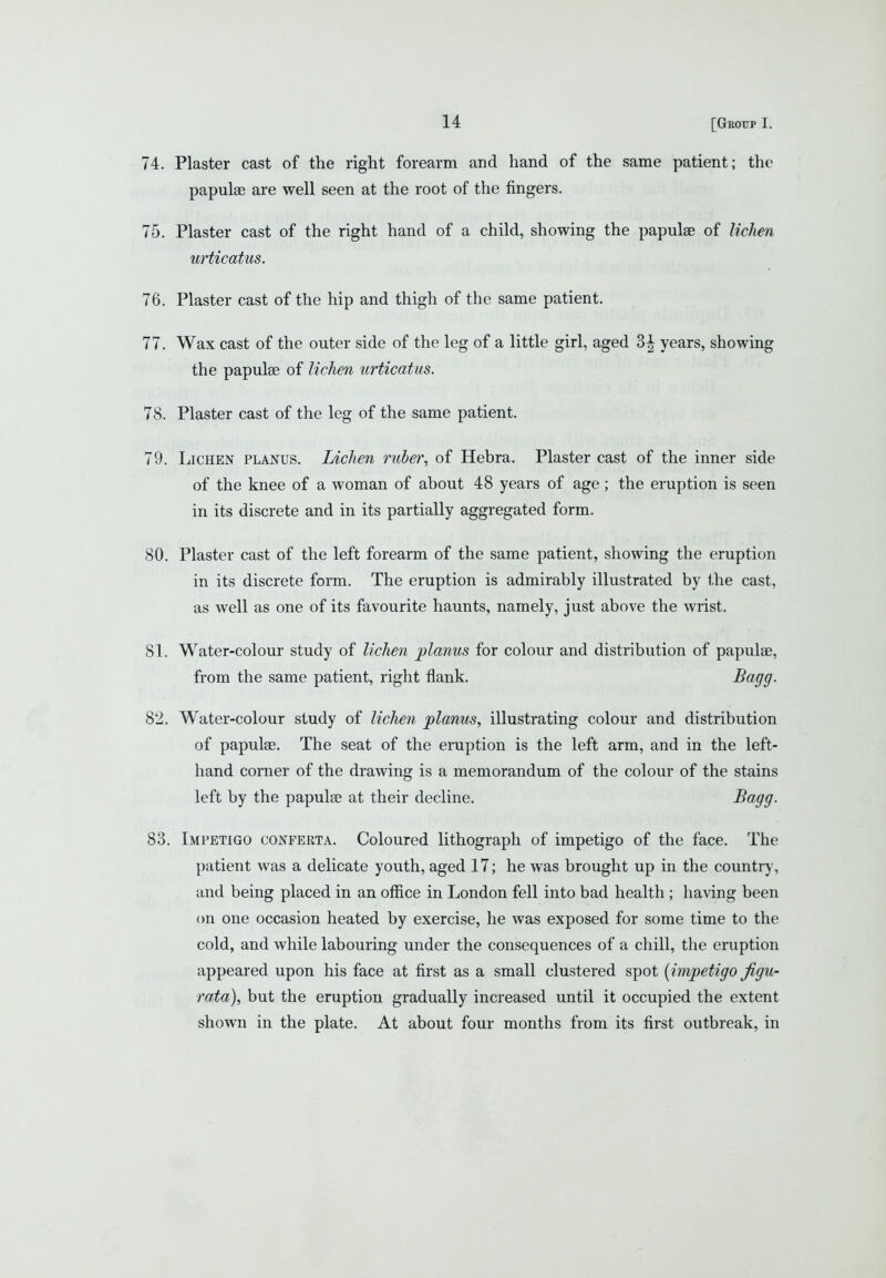 74. Plaster cast of the right forearm and hand of the same patient; the papulae are well seen at the root of the fingers. 75. Plaster cast of the right hand of a child, showing the papulae of lichen urticatus. 76. Plaster cast of the hip and thigh of the same patient. 77. Wax cast of the outer side of the leg of a little girl, aged 3^ years, showing the papulae of lichen urticatus. 78. Plaster cast of the leg of the same patient. 79. Lichen planus. Lichen ruber, of Hebra. Plaster cast of the inner side of the knee of a woman of about 48 years of age; the eruption is seen in its discrete and in its partially aggregated form. 80. Plaster cast of the left forearm of the same patient, showing the eruption in its discrete form. The eruption is admirably illustrated by the cast, as well as one of its favourite haunts, namely, just above the wrist. 81. Water-colour study of lichen planus for colour and distribution of papulae, from the same patient, right flank. I^agg- 82. Water-colour study of lichen planus, illustrating colour and distribution of papulae. The seat of the eruption is the left arm, and in the left- hand corner of the drawing is a memorandum of the colour of the stains left by the papulae at their decline. Sagg. 83. Impetigo conperta. Coloured lithograph of impetigo of the face. The patient was a delicate youth, aged 17; he was brought up in the country, and being placed in an ofiice in London fell into bad health ; having been on one occasion heated by exercise, he was exposed for some time to the cold, and while labouring under the consequences of a chill, the eruption appeared upon his face at first as a small clustered spot [impetigo Jigu- rata), but the eruption gradually increased until it occupied the extent shown in the plate. At about four months from its first outbreak, in