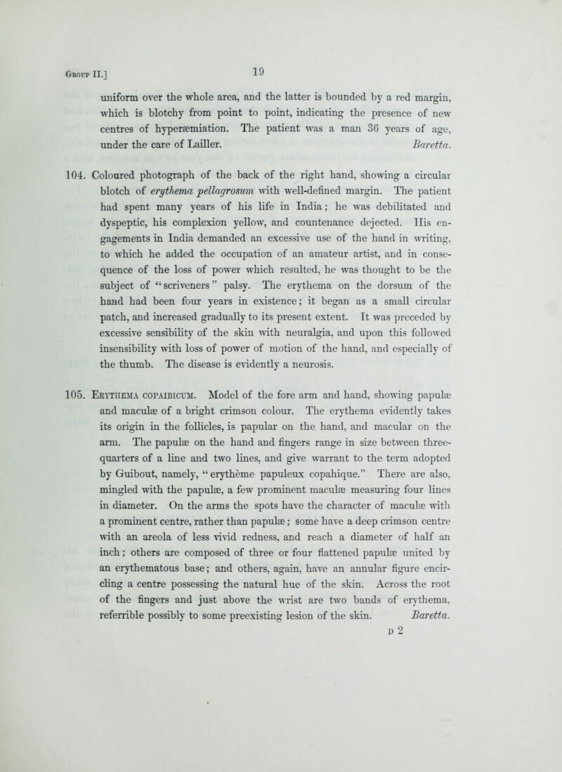 uniform over the whole area, and the latter is bounded by a red margin, which is blotchy from point to point, indicating the presence of new centres of hypersemiation. The patient was a man 36 years of age, under the care of Lailler. Baretta. 104. Coloured photograph of the back of the right hand, showing a cu-cular blotch of erythema jpellagrosum with well-defined margin. The patient had spent many years of his life in India; he was debilitated and dyspeptic, his complexion yellow, and countenance dejected. His en- gagements in India demanded an excessive use of the hand in writing, to which he added the occupation of an amateur artist, and in conse- quence of the loss of power which resulted, he was thought to be the subject of scriveners palsy. The erythema on the dorsum of the hand had been four years in existence; it began as a small circular patch, and increased gradually to its present extent. It was preceded by excessive sensibility of the skin with neuralgia, and upon this followed insensibility with loss of power of motion of the hand, and especially of the thumb. The disease is evidently a neurosis. 105. Eeythema copaibicum. Model of the fore arm and hand, showing papulae and maculae of a bright crimson colour. The erythema evidently takes its origin in the follicles, is papular on the hand, and macular on the arm. The papulae on the hand and fingers range in size between three- quarters of a line and two lines, and give warrant to the term adopted by Guibout, namely,  erytheme papuleux copahique. There are also, mingled with the papulae, a few prominent maculae measuring four lines in diameter. On the arms the spots have the character of maculae with a prominent centre, rather than papulae; some have a deep crimson centre with an areola of less \i\id redness, and reach a diameter of half an inch; others are composed of three or four flattened papulae united by an erythematous base; and others, again, have an annular figure encir- cling a centre possessing the natural hue of the skin. Across the root of the fingers and just above the wrist are two bands of eiythema, referrible possibly to some preexisting lesion of the skin. Baretta. D 2