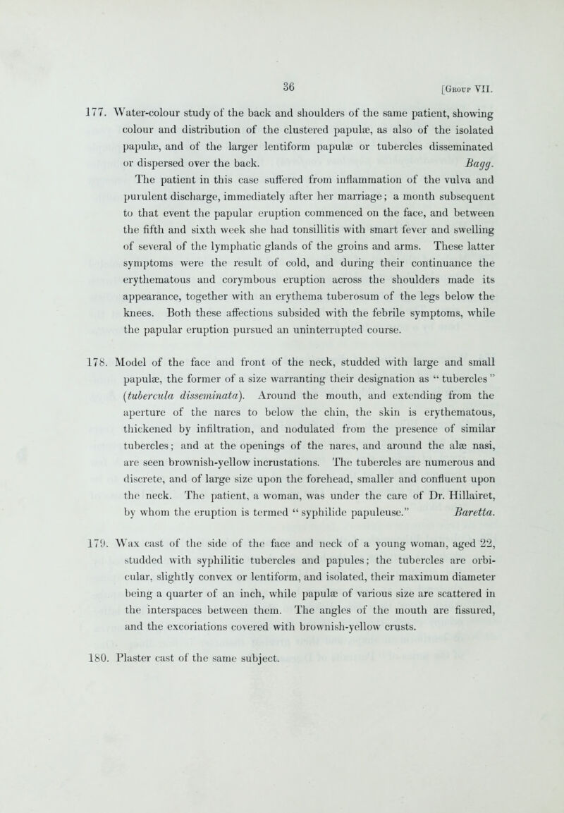 177. Water-colour study of the back and shoulders of the same patient, showing colour and distribution of the clustered papulae, as also of the isolated papulae, and of the larger lentiform papulse or tubercles disseminated or dispersed over the back. J^^gg. The patient in this case suffered from inflammation of the vulva and purulent discharge, immediately after her marriage; a month subsequent to that event the papular eruption commenced on the face, and between the fifth and sixth week she had tonsillitis with smart fever and swelling of several of the lymphatic glands of the groins and arms. These latter symptoms were the result of cold, and during their continuance the erythematous and corymbous eruption across the shoulders made its appearance, together with an erythema tuberosum of the legs below the knees. Both these affections subsided with the febrile symptoms, while the papular eruption pursued an uninterrupted course. 178. Model of the face and front of the neck, studded with large and small papulae, the former of a size warranting their designation as  tubercles  {tubercula disseminata). Around the mouth, and extending from the aperture of the nares to below the chin, the skin is erythematous, tliickened by infiltration, and nodulated from the presence of similar tubercles; and at the openings of the nares, and around the alae nasi, are seen brownish-yellow incrustations. The tubercles are numerous and discrete, and of large size upon the forehead, smaller and confluent upon the neck. The patient, a woman, was under the care of Dr. Hillairet, by whom the eruption is termed  syphilide papuleuse. Baretta. 179. Wax cast of the side of the face and neck of a young woman, aged 22, studded with syphilitic tubercles and papules; the tubercles are orbi- cular, slightly convex or lentiform, and isolated, their maximum diameter being a quarter of an inch, while papulae of various size are scattered in the interspaces between them. The angles of the mouth are fissured, and the excoriations covered with brownish-yellow crusts. 180. Plaster cast of the same subject.