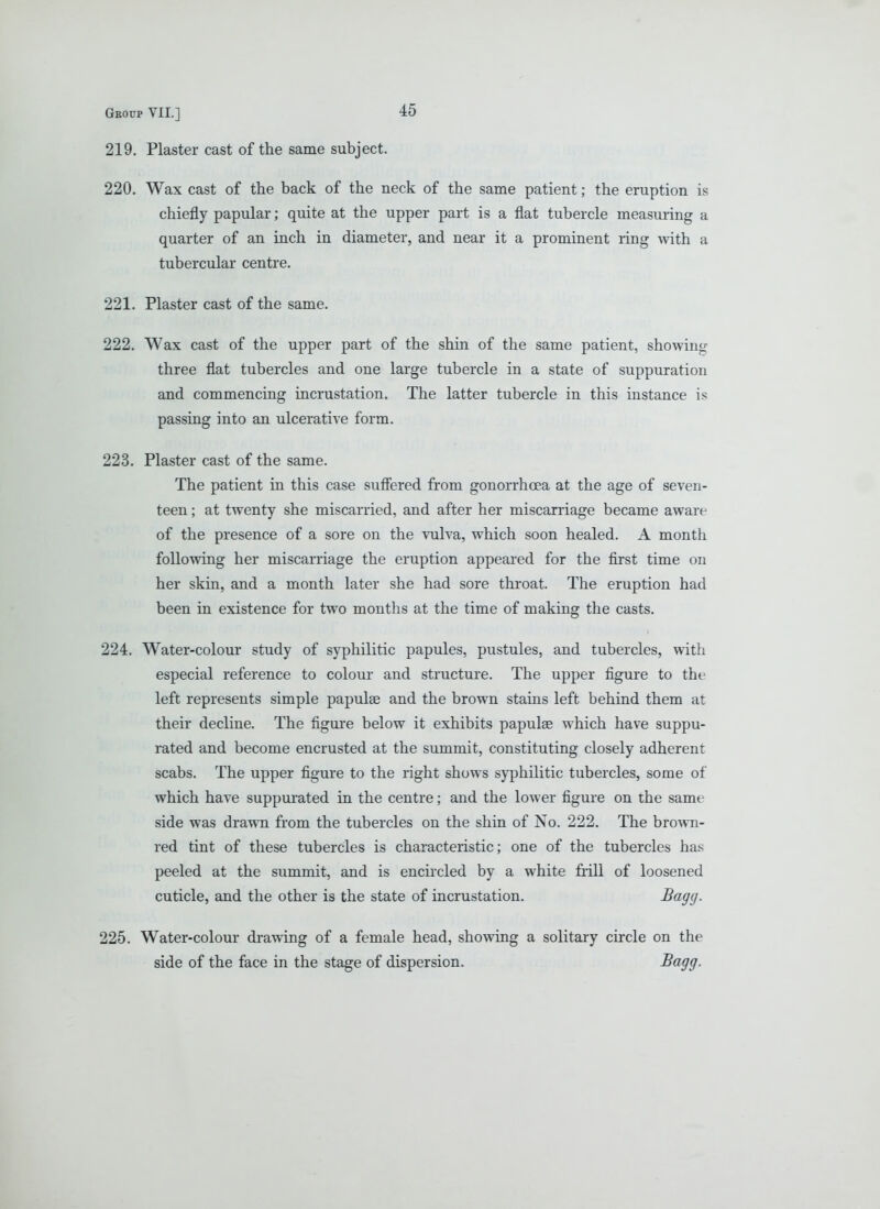 219. Plaster cast of the same subject. 220. Wax cast of the back of the neck of the same patient; the eruption is chiefly papular; quite at the upper part is a flat tubercle measuring a quarter of an inch in diameter, and near it a prominent ring with a tubercular centre. 221. Plaster cast of the same. 222. Wax cast of the upper part of the shin of the same patient, showing three flat tubercles and one large tubercle in a state of suppuration and commencing incrustation. The latter tubercle in this instance is passing into an ulcerative form. 223. Plaster cast of the same. The patient in this case suffered from gonorrhoea at the age of seven- teen ; at twenty she miscarried, and after her miscarriage became aware of the presence of a sore on the vulva, which soon healed. A month following her miscarriage the eruption appeared for the first time on her skin, and a month later she had sore throat. The eruption had been in existence for two months at the time of making the casts. 224. Water-colour study of syphilitic papules, pustules, and tubercles, with especial reference to colour and structure. The upper figure to the left represents simple papulae and the brown stains left behind them at their decline. The figure below it exhibits papulae which have suppu- rated and become encrusted at the summit, constituting closely adherent scabs. The upper figure to the right shows syphilitic tubercles, some of which have suppurated in the centre; and the lower figure on the same side was drawn from the tubercles on the shin of No. 222. The bro^vn- red tint of these tubercles is characteristic; one of the tubercles has peeled at the summit, and is encircled by a white frill of loosened cuticle, and the other is the state of incrustation. Scig(J- 225. Water-colour drawing of a female head, showing a solitary circle on the side of the face in the stage of dispersion. I^ogg-
