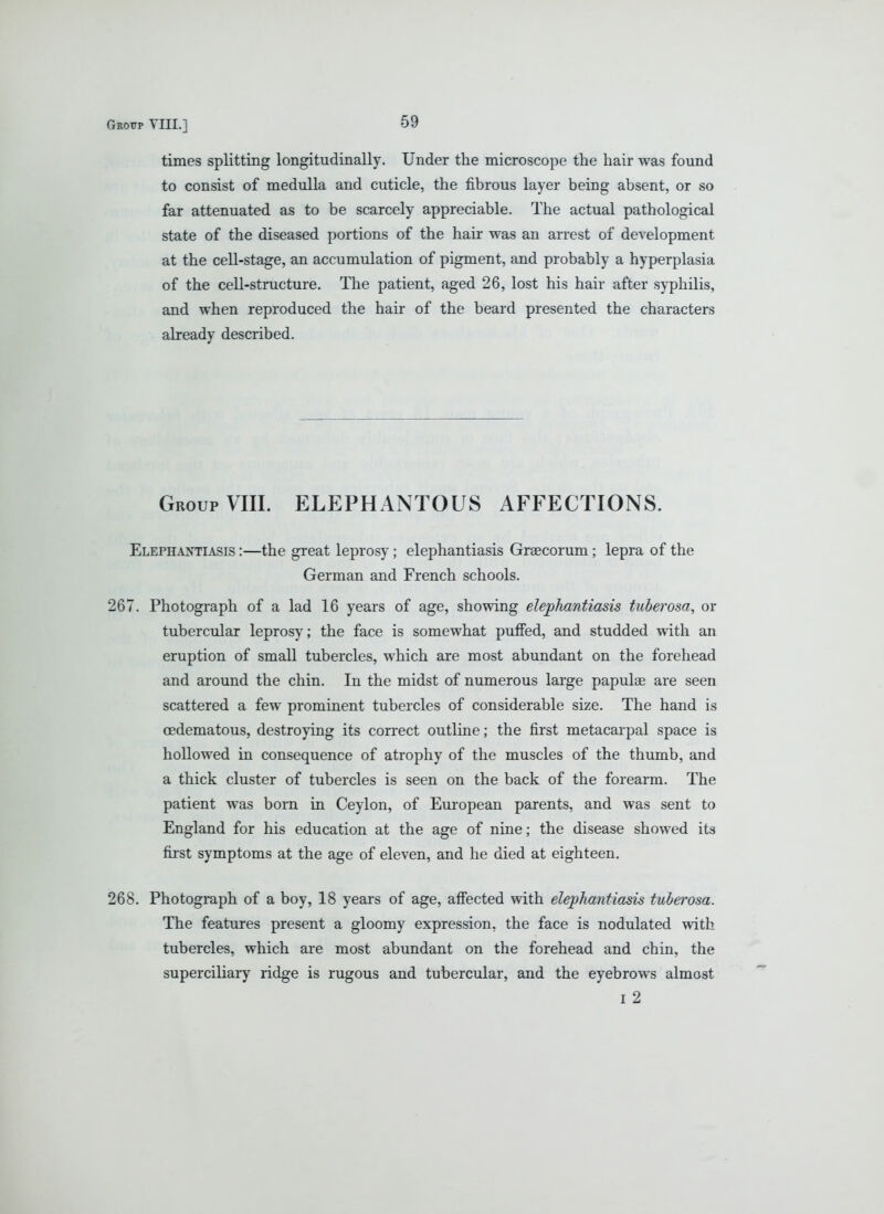 times splitting longitudinally. Under the microscope the hair was found to consist of medulla and cuticle, the fibrous layer being absent, or so far attenuated as to be scarcely appreciable. The actual pathological state of the diseased portions of the hair was an arrest of development at the cell-stage, an accumulation of pigment, and probably a hyperplasia of the cell-structure. The patient, aged 26, lost his hair after syphilis, and when reproduced the hair of the beard presented the characters already described. Group VIII. ELEPHANTOUS AFFECTIONS. Elephantiasis :—the great leprosy; elephantiasis Graecorum; lepra of the German and French schools. 267. Photograph of a lad 16 years of age, showing elephantiasis tuberosa, or tubercular leprosy; the face is somewhat puffed, and studded with an eruption of small tubercles, which are most abundant on the forehead and around the chin. In the midst of numerous large papulae are seen scattered a few prominent tubercles of considerable size. The hand is cedematous, destroying its correct outline; the first metacarpal space is hollowed in consequence of atrophy of the muscles of the thumb, and a thick cluster of tubercles is seen on the back of the forearm. The patient was born in Ceylon, of European parents, and was sent to England for his education at the age of nine; the disease showed its first symptoms at the age of eleven, and he died at eighteen. 268. Photograph of a boy, 18 years of age, affected with elephantiasis tuberosa. The features present a gloomy expression, the face is nodulated with tubercles, which are most abundant on the forehead and chin, the superciliary ridge is rugous and tubercular, and the eyebrows almost I 2