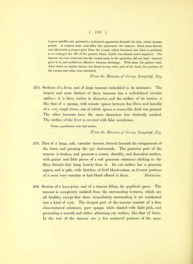 it grew painful, and presented a nodulated appearance beneath the skin, which became purple. A surgeon some time after this punctured the tumour: blood alone flowed, and afterwards a fungus grew from the wound, which increased and bled so profusely as to endanger the life of the patient, whose health was already much impaired. The tumour was now removed, but the wound made in the operation did not heal: tumours grew in it, and yielded an offensive ichorous discharge. With these the patient sank. After death no similar disease was found in any other part of the body, but portions of the coecum and colon were ulcerated. From the Museum of George Langstaff, Esq. 254. Sections of a liver, and of large tumours imbedded in its substance. The largest and most distinct of these tumours has a well-defined circular outline: it is three inches in diameter, and the surface of its section is like that of a sponge, with minute spaces between fine fibres and lamellae of a very tough tissue, out of which spaces a cream-like fluid was pressed. The other tumours have the same characters less distinctly marked. The surface of the liver is covered with false membrane. From a gentleman who had ascites. From the Museum of George Langstaff, Esq. 255. Part of a large, soft, vascular tumour, formed beneath the integuments of the brow, and pressing the eye downwards. The posterior part of the tumour is broken, and presents a coarse, shreddy, and flocculent surface, with grains and little pieces of a soft grumous substance sticking to the filmy threads that hang loosely from it. Its cut surface has a grumous aspect, and is pale, with blotches of livid blood-colour, as if some portions of it were very vascular or had blood eflTused in them. Hunterian. 256. Section of a knee-joint, and of a tumour filling the popliteal space. The tumour is completely isolated from the surrounding textures, which are all healthy, except that those immediately surrounding it are condensed into a kind of cyst. The deepest part of the tumour consists of a firm close-textured substance, pure opaque white shaded with light pink, and presenting a smooth and rather glistening cut surface, like that of brain. In the rest of the tumour are a few scattered portions of the same