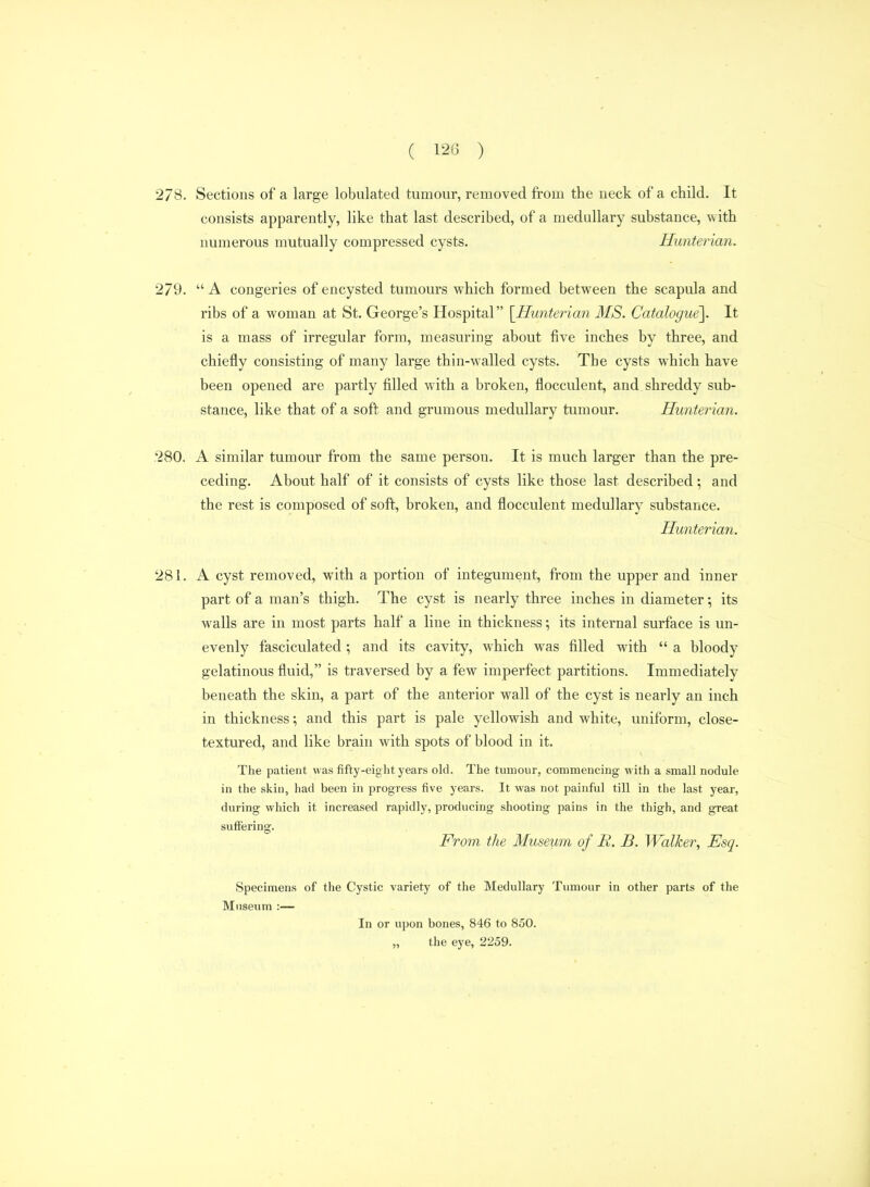 278. Sections of a large lobulated tumour, removed from the ueck of a child. It consists apparently, like that last described, of a medullary substance, with numerous mutually compressed cysts. Hunterian. 279.  A congeries of encysted tumours which formed between the scapula and ribs of a woman at St. George's Hospital [^Hunterian MS. Catalogue]. It is a mass of irregular form, measuring about five inches by three, and chiefly consisting of many large thin-walled cysts. The cysts which have been opened are partly filled with a broken, flocculent, and shreddy sub- stance, like that of a soft and grumous medullary tumour. Hunterian. 280. A similar tumour from the same person. It is much larger than the pre- ceding. About half of it consists of cysts like those last described; and the rest is composed of soft, broken, and flocculent medullary substance. Hunterian. 281. A cyst removed, with a portion of integument, from the upper and inner part of a man's thigh. The cyst is nearly three inches in diameter; its walls are in most parts half a line in thickness; its internal surface is un- evenly fasciculated; and its cavity, which was filled with  a bloody gelatinous fluid, is traversed by a few imperfect partitions. Immediately beneath the skin, a part of the anterior wall of the cyst is nearly an inch in thickness; and this part is pale yellowish and white, uniform, close- textured, and like brain with spots of blood in it. The patient was fifty-eight years old. The tumour, commencing with a small nodule in the skin, had been in progress five years. It was not painful till in the last year, during which it increased rapidly, producing shooting pains in the thigh, and great suffering. From the Museum of B. B. Walker, Esq. Specimens of the Cystic variety of the Medullary Tumour in other parts of the Museum :— In or upon bones, 846 to 850. „ the eye, 2259.