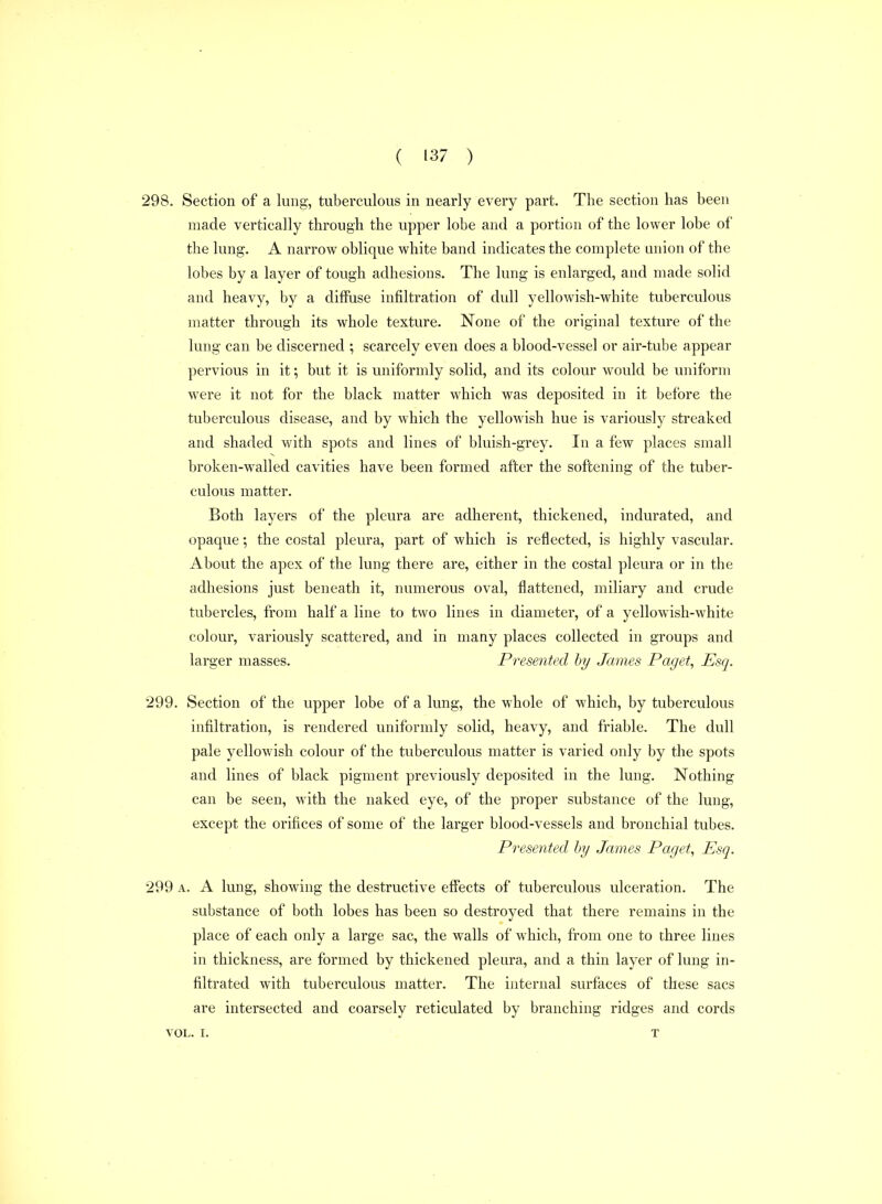 298. Section of a lung, tuberculous in nearly every part. The section has been made vertically through the upper lobe and a portion of the lower lobe of the lung. A narrow oblique white band indicates the complete union of the lobes by a layer of tough adhesions. The lung is enlarged, and made solid and heavy, by a diffuse infiltration of dull yellowish-white tuberculous matter through its whole texture. None of the original texture of the lung can be discerned ; scarcely even does a blood-vessel or air-tube appear pervious in it; but it is uniformly solid, and its colour would be uniform were it not for the black matter which was deposited in it before the tuberculous disease, and by which the yelloM'ish hue is variously streaked and shaded with spots and lines of bluish-grey. In a few places small broken-walled cavities have been formed after the softening of the tuber- culous matter. Both layers of the pleura are adherent, thickened, indurated, and opaque; the costal pleura, part of which is reflected, is highly vascular. About the apex of the lung there are, either in the costal pleura or in the adhesions just beneath it, numerous oval, flattened, miliary and crude tubercles, from half a line to two lines in diameter, of a yellowish-white colour, variously scattered, and in many places collected in groups and larger masses. Presented by James Paget, Esq. 299. Section of the upper lobe of a lung, the whole of which, by tuberculous infiltration, is rendered uniformly solid, heavy, and friable. The dull pale yellowish colour of the tuberculous matter is varied only by the spots and lines of black pigment previously deposited in the lung. Nothing can be seen, with the naked eye, of the proper substance of the lung, except the orifices of some of the larger blood-vessels and bronchial tubes. Presented by James Paget, Esq. 299 A. A lung, showing the destructive effects of tuberculous ulceration. The substance of both lobes has been so destroyed that there remains in the place of each only a large sac, the walls of which, from one to three lines in thickness, are formed by thickened pleura, and a thin layer of lung in- filtrated with tuberculous matter. The internal surfaces of these sacs are intersected and coarsely reticulated by branching ridges and cords VOL. I. T