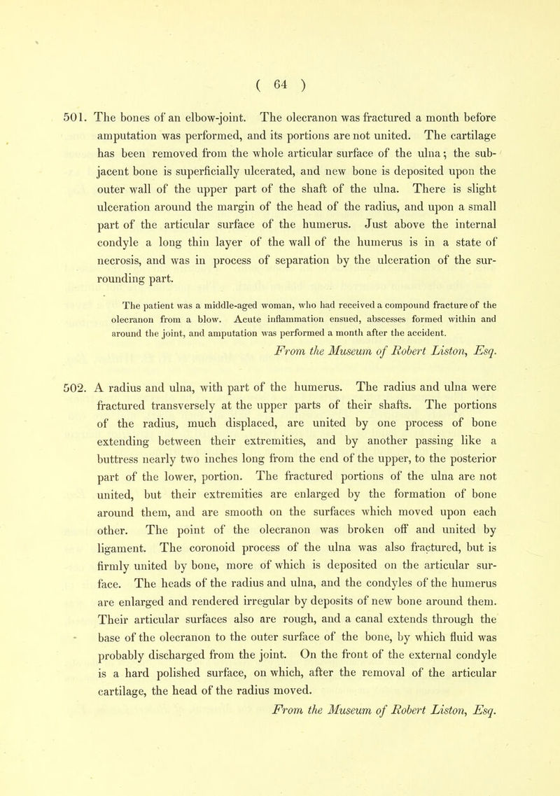 501. The bones of an elbow-joint. The olecranon was fractured a month before amputation was performed, and its portions are not united. The cartilage has been removed from the whole articular surface of the ulna; the sub- jacent bone is superficially ulcerated, and new bone is deposited upon the outer wall of the upper part of the shaft of the ulna. There is slight ulceration around the margin of the head of the radius, and upon a small part of the articular surface of the humerus. Just above the internal condyle a long thin layer of the wall of the humerus is in a state of necrosis, and was in process of separation by the ulceration of the sur- rounding part. The patient was a middle-aged woman, who had received a compound fracture of the olecranon from a blow. Acute inflammation ensued, abscesses formed within and around the joint, and amputation was performed a month after the accident. From the Museum of Robert Listen, Esq. 502. A radius and ulna, with part of the humerus. The radius and ulna were fractured transversely at the upper parts of their shafts. The portions of the radius, much displaced, are united by one process of bone extending between their extremities, and by another passing like a buttress nearly two inches long from the end of the upper, to the posterior part of the lower, portion. The fractured portions of the ulna are not united, but their extremities are enlarged by the formation of bone around them, and are smooth on the surfaces which moved upon each other. The point of the olecranon was broken off and united by ligament. The coronoid process of the ulna was also fractured, but is firmly united by bone, more of which is deposited on the articular sur- face. The heads of the radius and ulna, and the condyles of the humerus are enlarged and rendered irregular by deposits of new bone around them. Their articular surfaces also are rough, and a canal extends through the base of the olecranon to the outer surface of the bone, by which fluid was probably discharged from the joint. On the front of the external condyle is a hard polished surface, on which, after the removal of the articular cartilage, the head of the radius moved. From the Museum of Robert Liston, Esq.