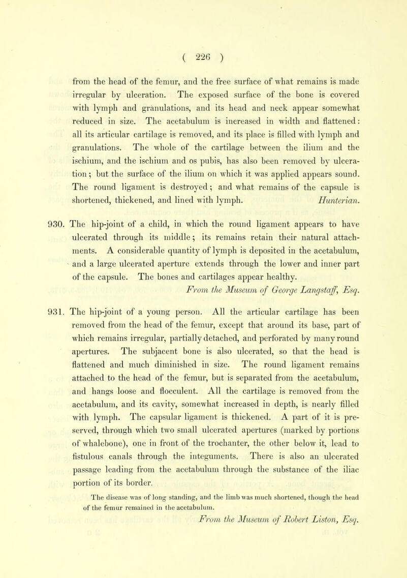 from the head of the femur, and the free surface of what remains is made irregular by ulceration. The exposed surface of the bone is covered with lymph and granulations, and its head and neck appear somewhat reduced in size. The acetabulum is increased in width and flattened: all its articular cartilage is removed, and its place is filled with lymph and granulations. The whole of the cartilage between the ilium and the ischium, and the ischium and os pubis, has also been removed by ulcera- tion; but the surface of the ilium on which it was applied appears sound. The round ligament is destroyed; and what remains of the capsule is shortened, thickened, and lined with lymph. Hunterian. 930. The hip-joint of a child, in which the round ligament appears to have ulcerated through its middle; its remains retain their natural attach- ments. A considerable quantity of lymph is deposited in the acetabulum, • and a large ulcerated aperture extends through the lower and inner part of the capsule. The bones and cartilages appear healthy. From the Museum of George Langstaff^ Esq. 931. The hip-joint of a young person. All the articular cartilage has been removed from the head of the femur, except that around its base, part of which remains irregular, partially detached, and perforated by many round apertures. The subjacent bone is also ulcerated, so that the head is flattened and much diminished in size. The round ligament remains attached to the head of the femur, but is separated from the acetabulum, and hangs loose and flocculent. All the cartilage is removed from the acetabulum, and its cavity, somewhat increased in depth, is nearly filled with lymph. The capsular ligament is thickened. A part of it is pre- served, through which two small ulcerated apertures (marked by portions of whalebone), one in front of the trochanter, the other below it, lead to fistulous canals through the integuments. There is also an ulcerated passage leading from the acetabulum through the substance of the iliac portion of its border. The disease was of long standing, and the limb was much shortened, though the head of the femur remained in the acetabulum. From the Museum of Robert Liston, Esq.