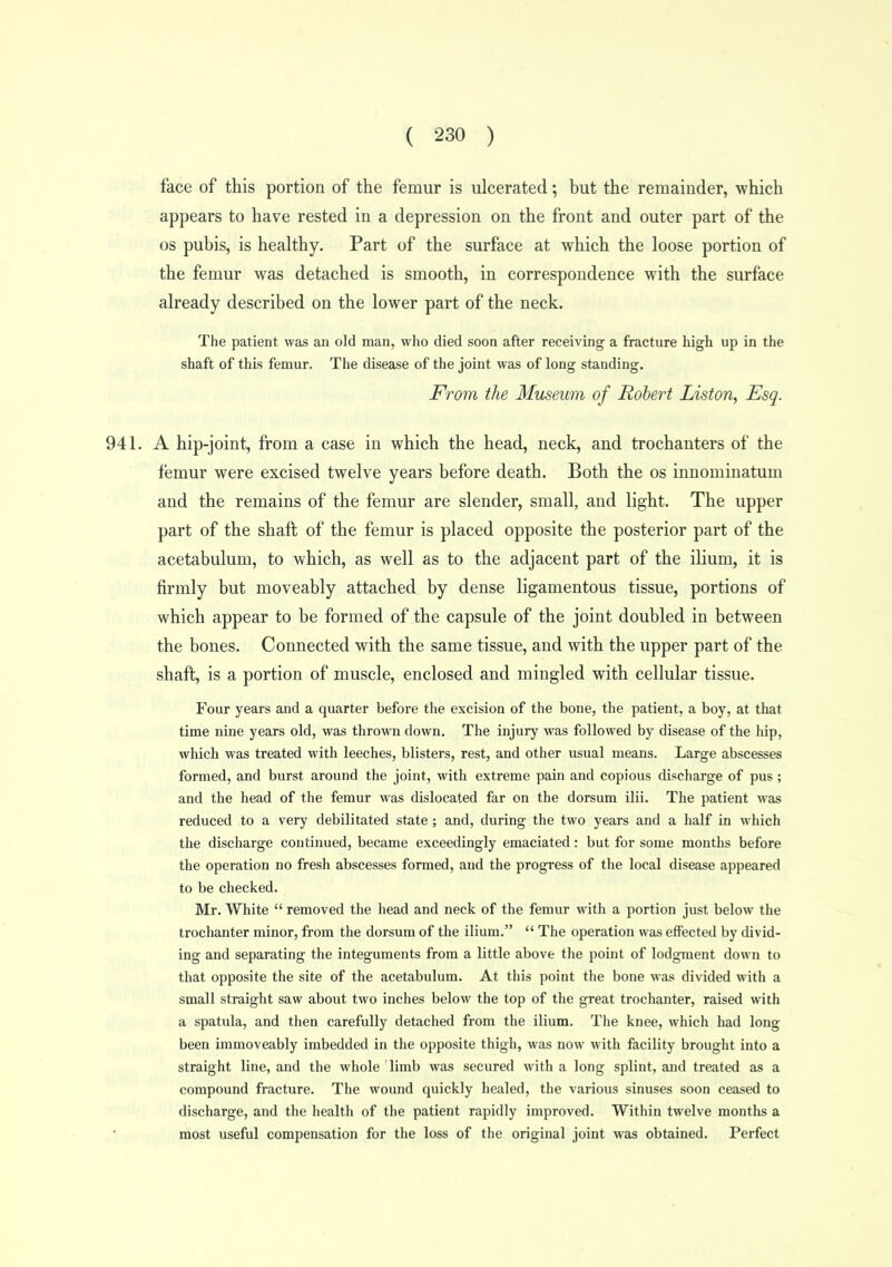 face of this portion of the femur is ulcerated; but the remainder, which appears to have rested in a depression on the front and outer part of the OS pubis, is healthy. Part of the surface at which the loose portion of the femur was detached is smooth, in correspondence with the surface already described on the lower part of the neck. The patient was an old man, who died soon after receiving a fracture high up in the shaft of this femur. The disease of the joint was of long standing. From the Museum of Roher^t Liston, Esq. 941. A hip-joint, from a case in which the head, neck, and trochanters of the femur were excised twelve years before death. Both the os innominatum and the remains of the femur are slender, small, and light. The upper part of the shaft of the femur is placed opposite the posterior part of the acetabulum, to which, as well as to the adjacent part of the ilium, it is firmly but moveably attached by dense ligamentous tissue, portions of which appear to be formed of the capsule of the joint doubled in between the bones. Connected with the same tissue, and with the upper part of the shaft, is a portion of muscle, enclosed and mingled with cellular tissue. Four years and a quarter before the excision of the bone, the patient, a boy, at that time nine years old, was thrown down. The injury was followed by disease of the hip, which was treated with leeches, blisters, rest, and other usual means. Large abscesses formed, and burst around the joint, with extreme pain and copious discharge of pus ; and the head of the femur was dislocated far on the dorsum ilii. The patient was reduced to a very debilitated state ; and, during the two years and a half in which the discharge continued, became exceedingly emaciated: but for some months before the operation no fresh abscesses formed, and the progress of the local disease appeared to be checked. Mr. White  removed the head and neck of the femur with a portion just below the trochanter minor, from the dorsum of the ilium.  The operation was effected by divid- ing and separating the integuments from a little above the point of lodgment down to that opposite the site of the acetabulum. At this point the bone was divided with a small straight saw about two inches below the top of the great trochanter, raised with a spatula, and then carefully detached from the ilium. The knee, which had long been immoveably imbedded in the opposite thigh, was now with facility brought into a straight line, and the whole limb was secured with a long splint, and treated as a compound fracture. The wound quickly healed, the various sinuses soon ceased to discharge, and the liealth of the patient rapidly improved. Within twelve months a most useful compensation for the loss of the original joint was obtained. Perfect