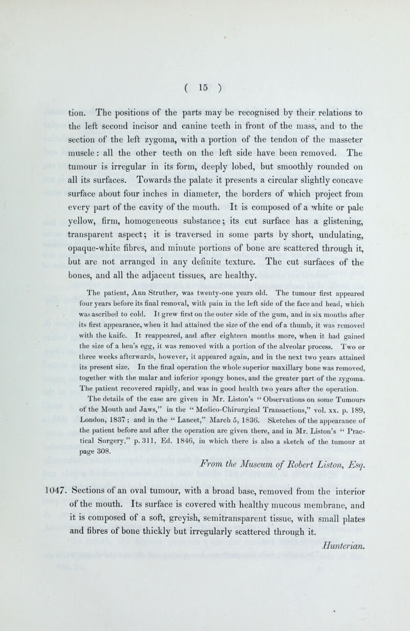 tion. The positions of the parts may be recognised by their relations to the left second incisor and canine teeth in front of the mass, and to the section of the left zygoma, with a portion of the tendon of the masseter muscle : all the other teeth on the left side have been removed. The tumour is irregular in its form, deeply lobed, but smoothly rounded on all its surfaces. Towards the palate it presents a circular slightly concave surface about four inches in diameter, the borders of which project from every part of the cavity of the mouth. It is composed of a white or pale yellow, firm, homogeneous substance; its cut surface has a glistening, transparent aspect; it is traversed in some parts by short, undulating, opaque-white fibres, and minute portions of bone are scattered through it, but are not arranged in any definite texture. The cut surfaces of the bones, and all the adjacent tissues, are healthy. The patient, Ann Struther, was twenty-one years old. The tumour first appeared four years before its final removal, with pain in the left side of the face and head, which was ascribed to cold. It grew first on the outer side of the gum, and in six months after its first appearance, when it had attained the size of the end of a thumb, it was removed with the knife. It reappeared, and after eighteen months more, when it had gained the size of a hen's egg, it was removed with a portion of the alveolar process. Two or three weeiis afterwards, liowever, it appeared again, and in the next two years attained its present size. In the final operation the whole superior maxillary bone was removed, together with the malar and inferior spongy bones, and the greater part of the zygoma. The patient recovered rapidly, and was in good health two years after the operation. The details of the case are given in Mr. Listen's  Observations on some Tumours of the Mouth and Jaws, in the  Medico-Chirurgical Transactions, vol. xx. p. 189, London, 1837 ; and in the  Lancet, March 5, 1836. Sketches of the appearance of the patient before and after the operation are given there, and in Mr. Liston's  Prac- tical Surgery, p. 311, Ed. 1846, in which there is also a sketch of the tumour at page 308. From the Museum of Robert Liston, Esq. 1047. Sections of an oval tumour, with a broad base, removed from the interior of the mouth. Its surface is covered with healthy mucous membrane, and it is composed of a soft, greyish, semitransparent tissue, with small plates and fibres of bone thickly but irregularly scattered through it. Hunterian.