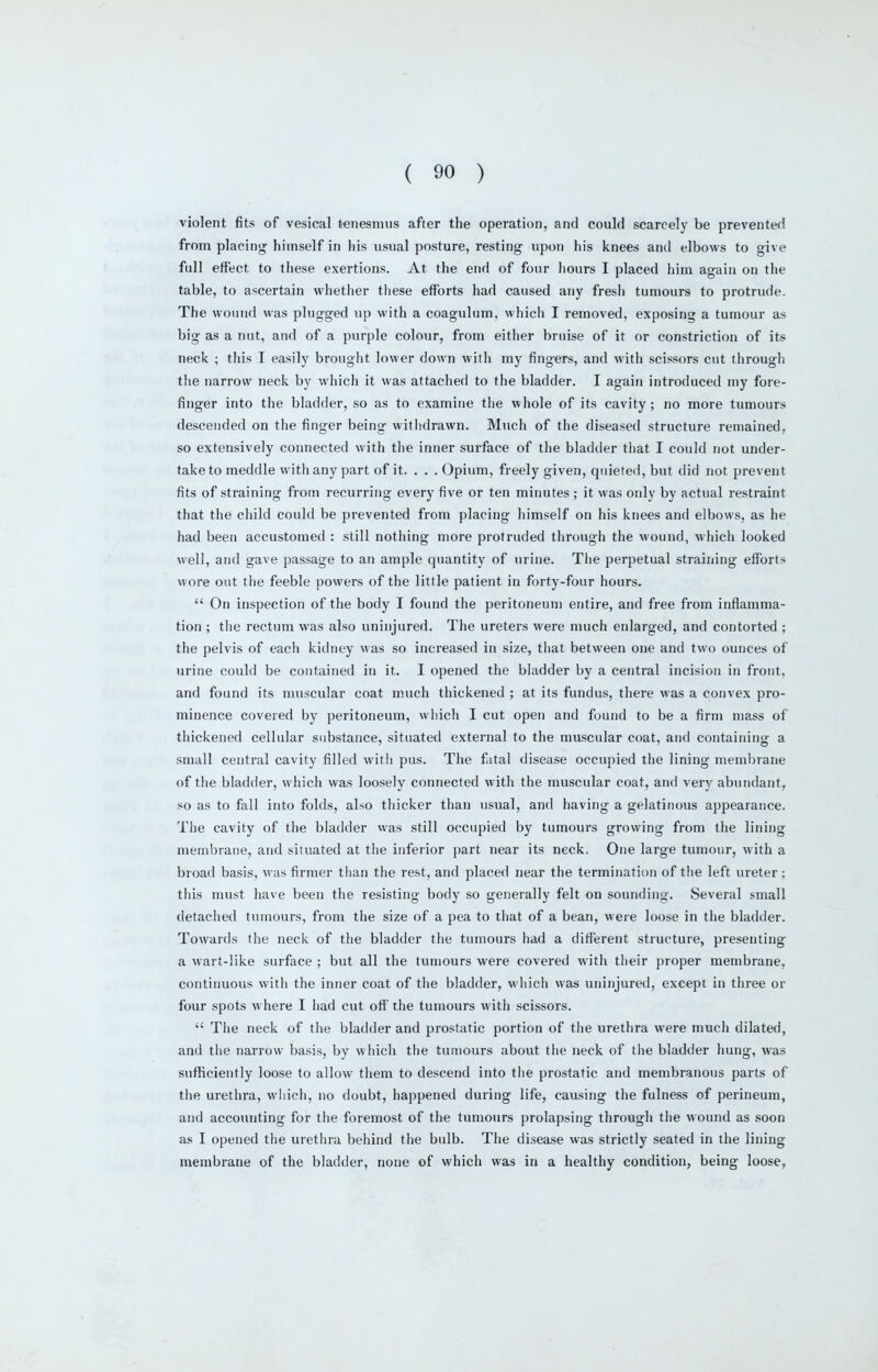 violent fits of vesical tenesmus after the operation, and could scarcely be prevented from placing himself in his usual posture, resting upon his knees and elbows to give full effect to these exertions. At the end of four hours I placed him again on the table, to ascertain whether these efforts had caused any fresh tumours to protrude. The wound was plugged up with a coagulum. which I removed, exposing a tumour as big as a nut, and of a purple colour, from either bruise of it or constriction of its neck ; this I easily brought lower down with my fingers, and with scissors cut tlirough the narrow neck by which it was attached to the bladder. I again introduced my fore- finger into the bladder, so as to examine the whole of its cavity; no more tumours descended on the finger being witlidrawn. Much of the diseased structure remained, so extensively connected with tlie inner surface of the bladder tliat I could not under- take to meddle with any part of it. . . . Opium, freely given, quieted, but did not prevent fits of straining from recurring every five or ten minutes; it was only by actual restraint that the ciiild could be prevented from placing himself on his knees and elbows, as he had been accustomed : still nothing more protruded through the wound, which looked well, and gave passage to an ample quantity of urine. Tlie perpetual straining efforts wore out tlie feeble powers of the little patient in forty-four hours.  On inspection of the body I found the peritoneum entire, and free from inflamma- tion ; the rectum was also uninjured. The ureters were much enlarged, and contorted ; the pelvis of each kidney was so increased in size, tiiat between one and two ounces of urine could be contained in it. I opened the bladder by a central incision in front, and found its muscular coat much thickened ; at its fundus, there was a convex pro- minence covered by peritoneum, which I cut open and found to be a firm mass of thickened cellular substance, situated external to the muscular coat, and containing a small central cavity filled with pus. The fatal disease occupied the lining membrane of the bladder, which was loosely connected with the muscular coat, and very abundant, so as to fall into folds, also thicker than usual, and having a gelatinous appearance. The cavity of the bladder was still occupied by tumours growing from the lining membrane, and siiuated at the inferior part near its neck. One large tumour, with a broad basis, was firmer tlian the rest, and placed near the termination of the left ureter: this must have been the resisting body so generally felt on sounding. Several small detached tumours, from the size of a pea to tiiat of a bean, were loose in the bladder. Towards the neck of the bladder the tumours liad a different structure, presenting a wart-like surface ; but all the tumours were covered with their proper membrane, continuous witii the inner coat of tiie bladder, wliicli was uninjured, except in three or four spots where I iiad cut off the tumours with scissors.  Tiie neck of the bladder and prostatic portion of the urethra were much dilated, and the narrow basis, by which the tumours about the neck of tlie bladder hung, was sufficiently loose to allow them to descend into the prostatic and membranous parts of the urethra, which, no doubt, happened during life, causing the fulness of perineum, and accounting for the foremost of the tumours prolapsing through the wound as soon as I opened the urethra behind the bulb. The disease was strictly seated in the lining membrane of the bladder, none of which was in a healthy condition, being loose,
