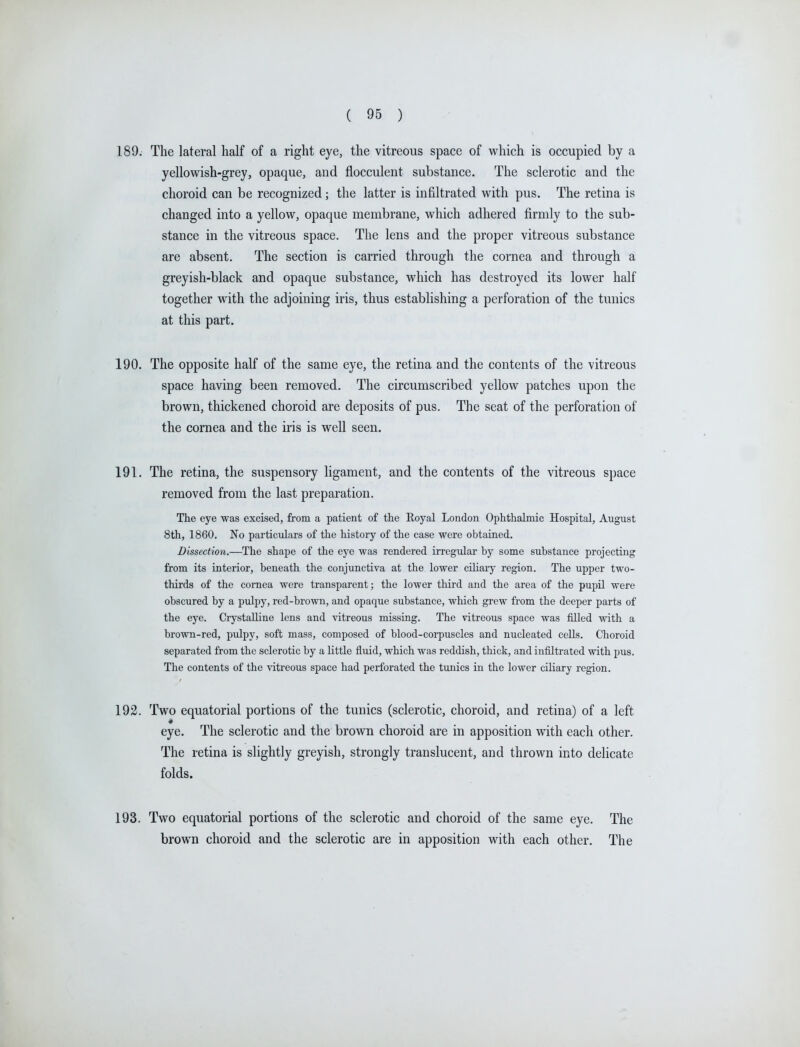 189. The lateral half of a right eye, the vitreous space of which is occupied by a yellowish-grey, opaque, and flocculent substance. The sclerotic and the choroid can be recognized; the latter is infiltrated with pus. The retina is changed into a yellow, opaque membrane, which adhered firmly to the sub- stance in the vitreous space. The lens and the proper vitreous substance are absent. The section is carried through the cornea and through a greyish-black and opaque substance, which has destroyed its lower half together with the adjoining iris, thus establishing a perforation of the tunics at this part. 190. The opposite half of the same eye, the retina and the contents of the vitreous space having been removed. The circumscribed yellow patches upon the brown, thickened choroid are deposits of pus. The seat of the perforation of the cornea and the iris is well seen. 191. The retina, the suspensory ligament, and the contents of the vitreous space removed from the last preparation. The eye was excised, from a patient of the Royal London Ophthalmic Hospital, August 8th, 1860. No particulars of the history of the case were obtained. Dissection.—The shape of the eye was rendered irregular by some substance projecting from its interior, beneath the conjunctiva at the lower ciliary region. The upper two- thirds of the cornea were transparent; the lower third and the area of the pupil were obscured by a pulpy, red-brown, and opaque substance, which grew from the deeper parts of the eye. Crystalline lens and vitreous missing. The vitreous space was filled with a brown-red, pulpy, soft mass, composed of blood-corpuscles and nucleated cells. Choroid separated from the sclerotic by a little fluid, which was reddish, thick, and infiltrated with pus. The contents of the vitreous space had perforated the tunics in the lower ciliary region. 192. Two equatorial portions of the tunics (sclerotic, choroid, and retina) of a left eye. The sclerotic and the brown choroid are in apposition with each other. The retina is slightly greyish, strongly translucent, and thrown into delicate folds. 193. Two equatorial portions of the sclerotic and choroid of the same eye. brown choroid and the sclerotic are in apposition with each other. The The