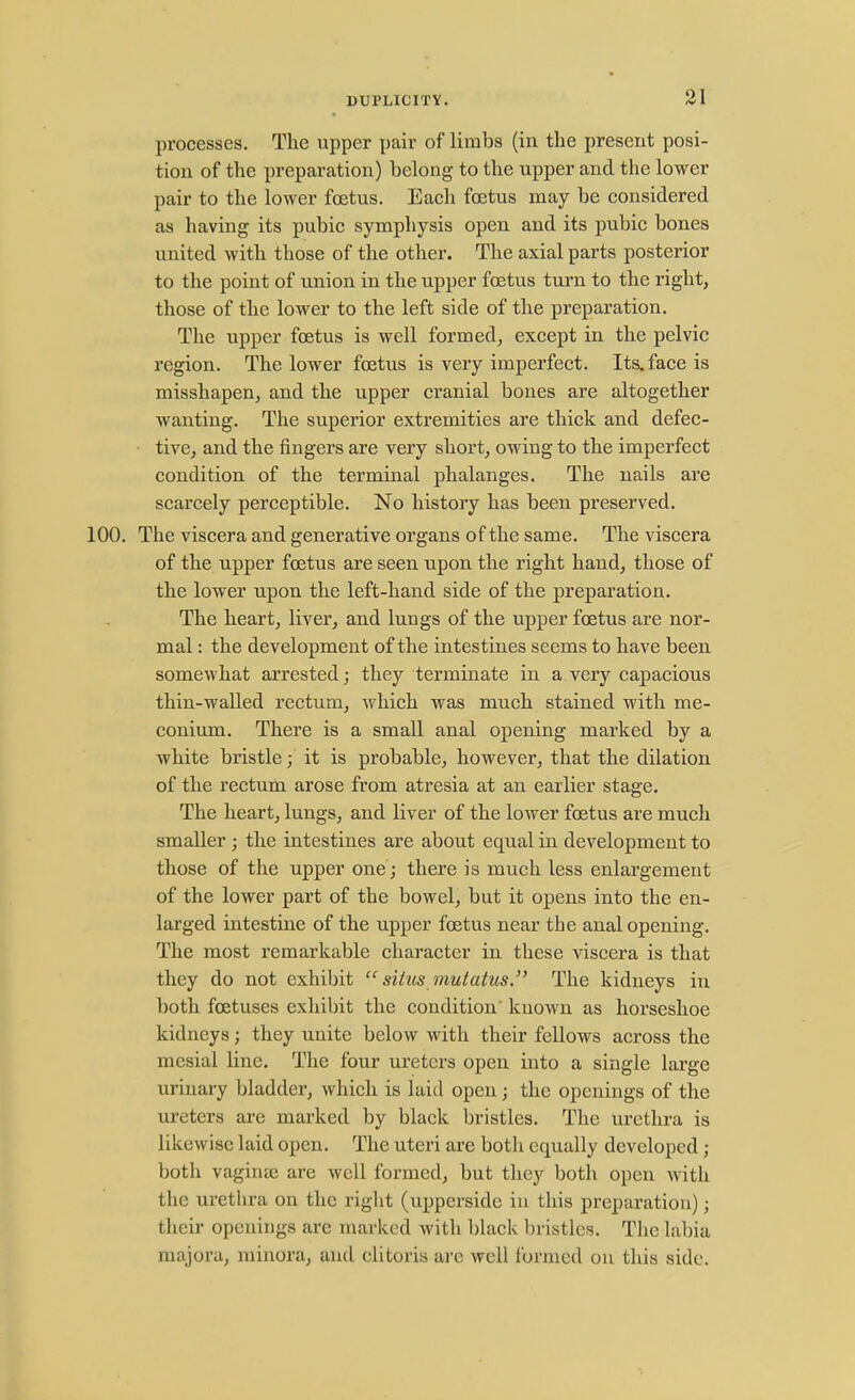 processes. The upper pair of limbs (in the present posi- tion of the preparation) belong to the upper and the lower pair to the lower foetus. Each foetus may be considered as having its pubic symphysis open and its pubic bones united with those of the other. The axial parts posterior to the point of union in the upper foetus turn to the right, those of the lower to the left side of the preparation. The upper foetus is well formed, except in the pelvic region. The lower foetus is very imperfect. Its. face is misshapen, and the upper cranial bones are altogether wanting. The superior extremities are thick and defec- tive, and the fingers are very short, owing to the imperfect condition of the terminal phalanges. The nails are scarcely perceptible. No history has been preserved. 100. The viscera and generative organs of the same. The viscera of the upper foetus are seen upon the right hand, those of the lower upon the left-hand side of the preparation. The heart, liver, and lungs of the upper foetus are nor- mal : the development of the intestines seems to have been somewhat arrested; they terminate in a very capacious thin-walled rectum, which was much stained with me- conium. There is a small anal opening marked by a white bristle; it is probable, however, that the dilation of the rectum arose from atresia at an earlier stage. The heart, lungs, and liver of the lower foetus are much smaller; the intestines are about equal in development to those of the upper one; there is much less enlargement of the lower part of the bowel, but it opens into the en- larged intestine of the upper foetus near the anal opening. The most remarkable character in these viscera is that they do not exhibit  situs mutatus. The kidneys in both foetuses exhibit the condition' known as horseshoe kidneys; they unite below with their fellows across the mesial line. The four ureters open into a single large urinary bladder, which is laid open; the openings of the ureters are marked by black bristles. The urethra is likewise laid open. The uteri are botli equally developed; both vaginae are well formed, but they both open with the urethra on the right (upperside in this preparation); their openings arc marked with black bristles. The labia majora, minora, and clitoris arc well formed on this side.