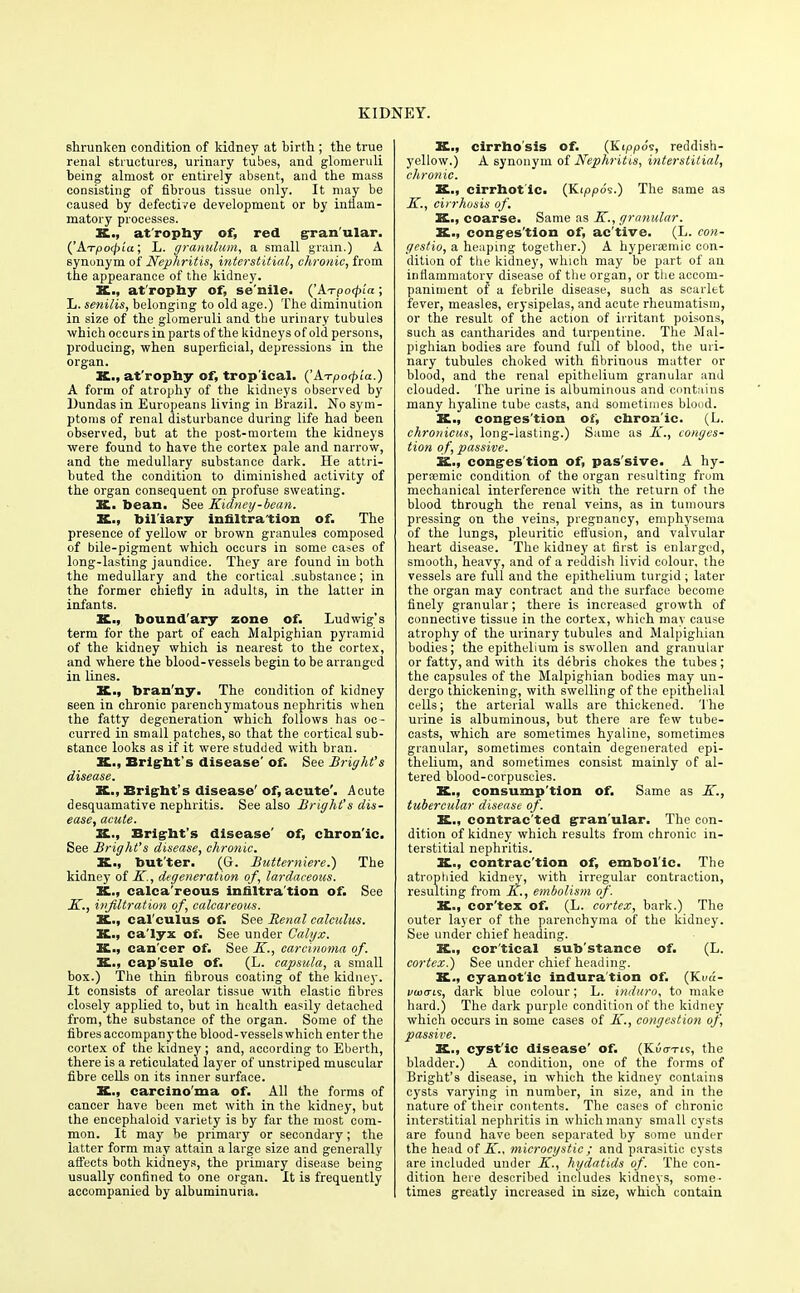 shrunken condition of kidney at birth ; the true renal structures, urinary tubes, and glomeruli being almost or entirely absent, and the mass consisting of fibrous tissue only. It may be caused by defective development or by inflam- matory processes. si., atrophy of, red granular. ('ATpotpia; L. granulum, a small gram.) A synonym of Nephritis, interstitial, chronic, from the appearance of the kidney. X., atrophy of, se'nile. ('Axpotpia; L. senilis, belonging to old age.) The diminution in size of the glomeruli and the urinary tubules which occurs in parts of the kidneys of old persons, producing, when superficial, depressions in the organ. X., at'rophy of, trop'ical. ('Axpo^ia.) A form of atrophy of the kidneys observed by Dundas in Europeans living in Brazil. No sym- ptoms of renal disturbance during life had been observed, but at the post-mortem the kidneys were found to have the cortex pale and narrow, and the medullary substance dark. He attri- buted the condition to diminished activity of the organ consequent on profuse sweating. X,. bean. See Kidney-bean. K... biliary innltra'tion of. The presence of yellow or brown granules composed of bile-pigment which occurs in some cases of long-lasting jaundice. They are found in both the medullary and the cortical .substance; in the former chiefly in adults, in the latter in infants. K., boundary zone of. Ludwig's term for the part of each Malpighian pyramid of the kidney which is nearest to the cortex, and where the blood-vessels begin to be arranged in lines. X., bran'ny. The condition of kidney seen in chronic parenchymatous nephritis when the fatty degeneration which follows has oc- curred in small patches, so that the cortical sub- stance looks as if it were studded with bran. X., Bright's disease' of. See Bright's disease. K., Bright's disease' of, acute'. Acute desquamative nephritis. See also Bright's dis- ease, acute. X., Bright's disease' of, chron'ic. See Bright's disease, chronic. K., but'ter. (G. Butter mere.) The kidney of K., degeneration of, lardaceous. K., calca'reous innltra'tion of. See E., infiltration of, calcareous. X., cal culus of. See Renal calculus. X., ca'lyx of. See under Calyx. K., can'cer of. See K., carcinoma of. K., cap'sule of. (L. capsula, a small box.) The thin fibrous coating of the kidney. It consists of areolar tissue with elastic fibres closely applied to, but in health easily detached from, the substance of the organ. Some of the fibres accompany the blood-vessels which enter the cortex of the kidney; and, according to Eberth, there is a reticulated layer of unstriped muscular fibre cells on its inner surface. K., carcino'ma of. All the forms of cancer have been met with in the kidney, but the encephaloid variety is by far the most com- mon. It may be primary or secondary; the latter form may attain a large size and generally affects both kidneys, the primary disease being usually confined to one organ. It is frequently accompanied by albuminuria. X., cirrhosis of. (Kippo's, reddish- yellow.) A synonym of Nephritis, interstitial, chronic. K., cirrhot ic. (Kippds.) The same as K., cirrhosis of, X., coarse. Same as K., granular. X., congestion of, ac'tive. (L. con- gestio, a heaping together.) A hypersmic con- dition of the kidney, which may be part of an inflammatory disease of the organ, or the accom- paniment of a febrile disease, such as scarlet fever, measles, erysipelas, and acute rheumatism, or the result of the action of irritant poisons, such as cantharides and turpentine. The Mal- pighian bodies are found full of blood, the uri- nary tubules choked with fibrinous matter or blood, and the renal epithelium granular and clouded. The urine is albuminous and contains many hyaline tube casts, and sometimes blood. K., congestion of, chron'ic. (L. chronicus, long-lasting.) Same as K., conges- tion of, passive. X., conges'tion of, pas'sive. A hy- persemic condition of the organ resulting from mechanical interference with the return of the blood through the renal veins, as in tumours pressing on the veins, pregnancy, emphj'sema of the lungs, pleuritic effusion, and valvular heart disease. The kidney at first is enlarged, smooth, heavy, and of a reddish livid colour, the vessels are full and the epithelium turgid ; later the organ may contract and the surface become finely granular; there is increased growth of connective tissue in the cortex, which may cause atrophy of the urinary tubules and Malpighian bodies; the epithelium is swollen and granular or fatty, and with its debris chokes the tubes; the capsules of the Malpighian bodies may un- dergo thickening, with swelling of the epithelial cells; the arterial walls are thickened. The urine is albuminous, but there are few tube- casts, which are sometimes hyaline, sometimes granular, sometimes contain degenerated epi- thelium, and sometimes consist mainly of al- tered blood-corpuscies. X., consump'tion of. Same as K., tubercular disease of. X., contrac ted granular. The con- dition of kidney which results from chronic in- terstitial nephritis. K., contrac'tion of, embolic. The atrophied kidney, with irregular contraction, resulting from K., embolism of. K., cor'tex of. (L. cortex, bark.) The outer layer of the parenchyma of the kidney. See under chief heading. K., cortical sub'stance of. (L. cortex.) See under chief heading. K., cyanotic indura'tion of. (Kvd- vasais, dark blue colour; L. induro, to make hard.) The dark purple condition of the kidney which occurs in some cases of K., congestion of, passive. K., cyst'ic disease' of. (Kuo-tis, the bladder.) A condition, one of the forms of Bright's disease, in which the kidney contains cysts varying in number, in size, and in the nature of their contents. The cases of chronic interstitial nephritis in which many small cysts are found have been separated by some under the head of K., microcystic ; and parasitic cysts are included under K., hydatids of. The con- dition here described includes kidneys, some- times greatly increased in size, which contain