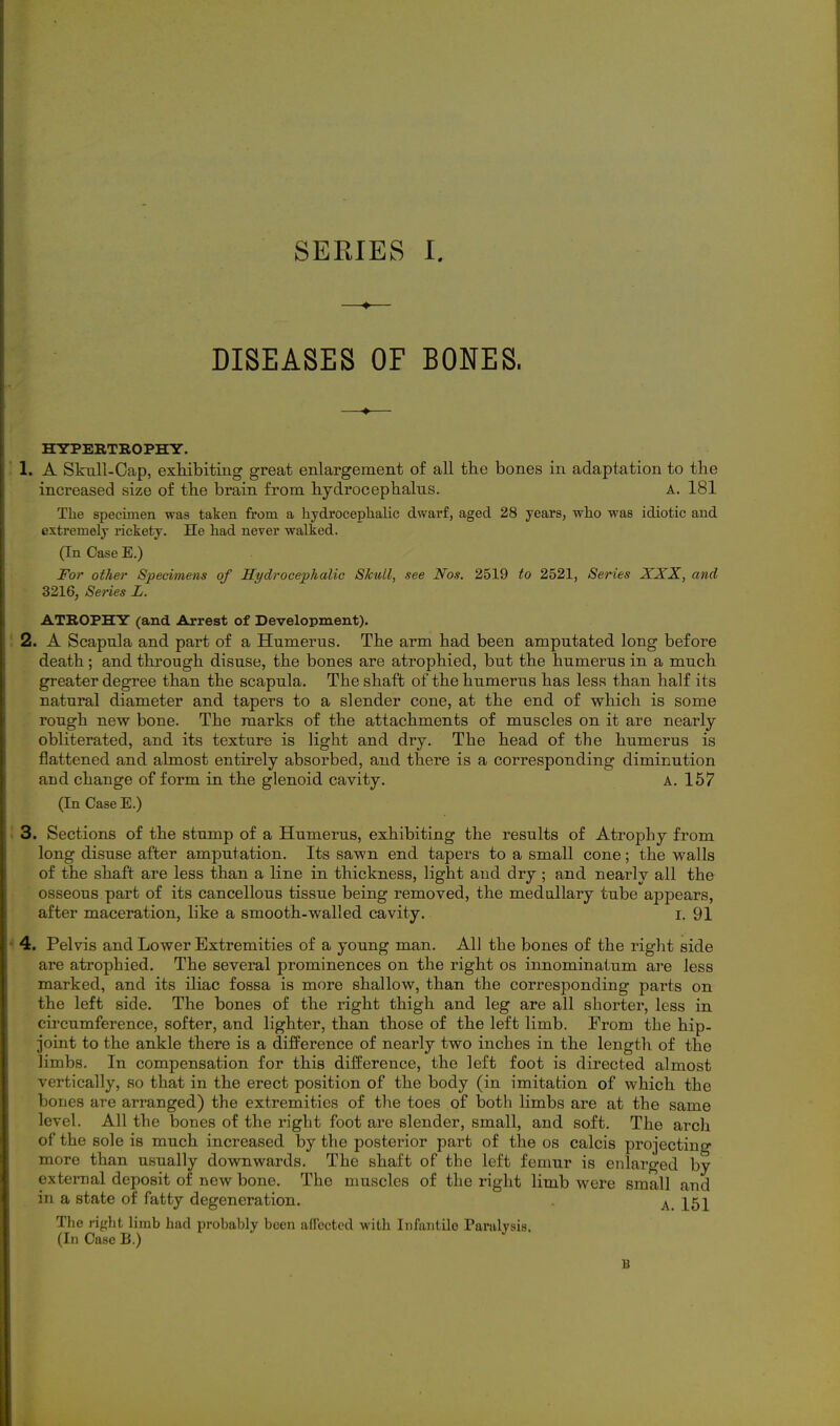 DISEASES OF BONES. HYPERTROPHY. 1. A Skull-Cap, exhibiting great enlargement of all the bones in adaptation to the increased size of the brain from hydrocephalus. A. 181 The specimen was taken from a hydroceplialic dwarf, aged 28 years, who was idiotic and extremely rickety. He had never walked. (In Case E.) For other Specimens of Hydrocephalic Skull, see Nos. 2519 to 2521, Series XXX, and 3216, Series L. ATROPHY (and Arrest of Development). 2. A Scapula and part of a Humerus. The arm had been amputated long before death; and through disuse, the bones are atrophied, but the humerus in a much greater degree than the scapula. The shaft of the humerus has less than half its natural diameter and tapers to a slender cone, at the end of which is some rough new bone. The marks of the attachments of muscles on it are nearly obliterated, and its texture is light and dry. The head of the humerus is flattened and almost entirely absorbed, and there is a corresponding diminution and change of form in the glenoid cavity. A. 157 (In Case E.) 3. Sections of the stump of a Humerus, exhibiting the results of Atrophy from long disuse after amputation. Its sawn end tapers to a small cone; the walls of the shaft are less than a line in thickness, light and dry ; and nearly all the osseous part of its cancellous tissue being removed, the medullary tube appears, after maceration, like a smooth-walled cavity. i. 91 4. Pelvis and Lower Extremities of a young man. All the bones of the right side are atrophied. The several prominences on the right os innominatum are less marked, and its iliac fossa is more shallow, than the corresponding parts on the left side. The bones of the right thigh and leg are all shorter, less in cii'cumference, softer, and lighter, than those of the left limb. From the hip- joint to the ankle there is a difference of nearly two inches in the length of the limbs. In compensation for this difference, the left foot is directed almost vertically, so that in the erect position of the body (in imitation of which the bones are arranged) the extremities of the toes of both limbs are at the same level. All the bones of the right foot are slender, small, and soft. The arch of the sole is much increased by the posterior part of the os calcis projecting more than usually downwards. The shaft of the left femur is enlarged by external deposit of new bone. The muscles of the right limb were small and in a state of fatty degeneration. The right limb had probably been affected with Infantile Paralysis. (In Case B.) ^ B