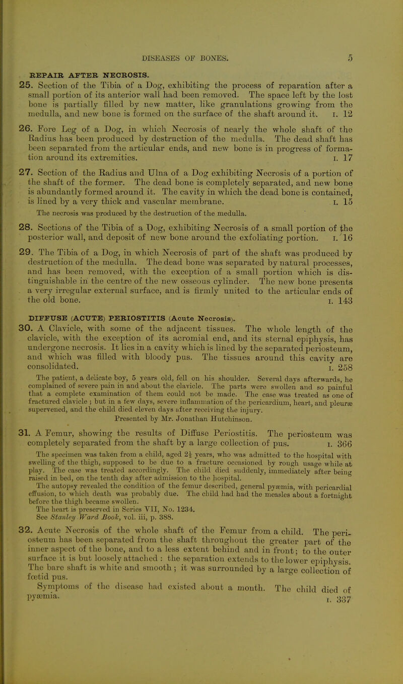 REPAIB AFTER NECROSIS. 25. Section of the Tibia of a Dog, exhibiting the process of reparation after a small portion of its anterior wall had been removed. The space left by the lost bone is partially filled by new matter, like granulations growing from the medulla, and new boue is formed on the surface oF the shaft ai'ound it. i. 12 26. Fore Leg of a Dog, in which Necrosis of nearly the whole shaft of the Radius has been produced by destruction of the medulla. The dead shaft has been separated from the articular ends, and new bone is in progress of forma- tion around its extremities. i, 17 27. Section of the Radius and Ulna of a Dog exhibiting Necrosis of a portion of the shaft of the former. The dead bone is completely separated, and new bone is abundantly formed around it. The cavity in which the dead bone is contained, is lined by a very thick and vascular membrane. i. 15 The necrosis was produced by tlie destruction of the medulla. 28. Sections of the Tibia of a Dog, exhibiting Necrosis of a small portion of the posterior wall, and deposit of new bone around the exfoliating portion. i. 16 29. The Tibia of a Dog, in which Necrosis of part of the shaft was produced by destruction of the medulla. The dead bone was separated by natural processes, and has been removed, with the exception of a small portion which is dis- tinguishable in the centre of the new osseous cylinder. The new bone presents a very irregular external surface, and is firmly united to the articular ends of the old bone. i. 143 DIEETJSE (ACUTE) PERIOSTITIS (Acute Necrosis). 30. A Clavicle, with some of the adjacent tissues. The whole length of the clavicle, with the exception of its acromial end, and its sternal epiphysis, has undergone necrosis. It lies in a cavity which is lined by the separated periosteum, and which was filled with bloody pus. The tissues around this cavity are consolidated. i. 258 The patient, a delicate boy, 5 years old, fell on his shoulder. Several days afterwards, he complained of severe pain in and about the clavicle. The parts were swollen and so painful that a complete examination of them could not be made. The case was treated as one of fractured clavicle ; but in a few days, severe inflammation of the pericardium, heart, and pleurae supervened, and the child died eleven days after receiving the injury. Presented by Mr. Jonathan Hutchinson, 31. A Femur, showing the results of Difi'use Periostitis. The periosteum was completely separated from the shaft by a large collection of pus. i, 366 The specimen was taken from a child, aged 2j years, who was admitted to the hospital with swelling of the thigh, supposed to be due to a fracture occasioned by rough usage whUe at play. The case was treated accordingly. The child died suddenly, immediately after being raised in bed, on the tenth day after admission to the hospital. The autopsy revealed the condition of the femur described, general pyaemia, with pericardial efPusion, to which death was probably due. The child had had the measles about a fortnight before the thigh became swollen. The heart is preserved in Series YII, No. 1234. See Stanley Ward Book, vol. iii, p. 388. 32. Acute Necrosis of the whole shaft of the Femur from a child. The peri- osteum has been separated from the shaft throughout the greater part of the inner aspect of the bone, and to a less extent behind and in front; to the outer surface it is but loosely attached : the separation extends to the lower ej^iphysis The bare shaft is white and smooth; it was surrounded by a large collection of foetid pus. Symptoms of the disease had existed about a month. The child died of pya3mia. ^ 337