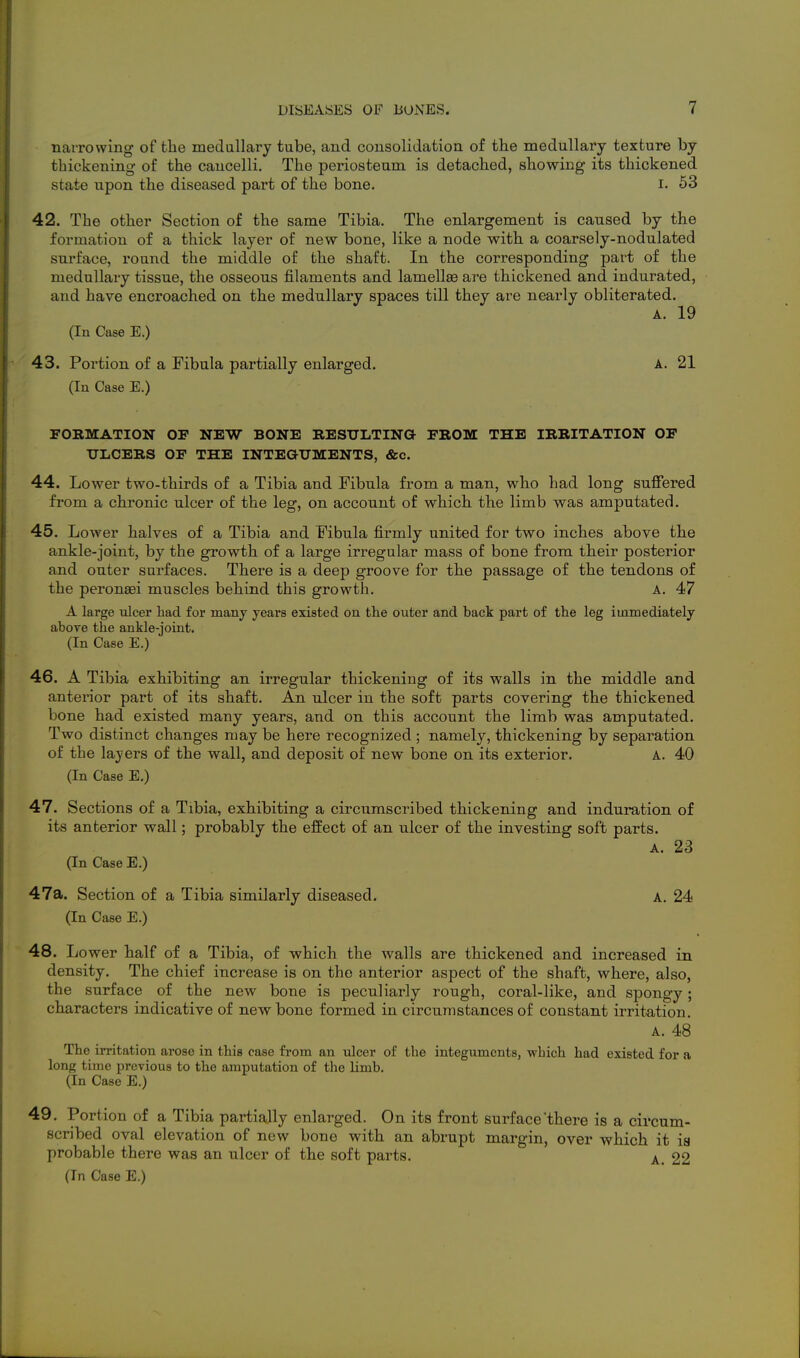narrowing of the medallary tube, and consolidation of the medullary texture by thickening of the cancelli. The periosteum is detached, showing its thickened state upon the diseased part of the bone. i. 63 42. The other Section of the same Tibia. The enlargement is caused by the formation of a thick layer of new bone, like a node with a coarsely-nodulated surface, round the middle of the shaft. In the corresponding part of the medullary tissue, the osseous filaments and lamellae are thickened and indurated, and have encroached on the medullary spaces till they are nearly obliterated. A. 19 (In Case E.) 43. Portion of a Fibula partially enlarged. A. 21 (In Case E.) FOBMATIOIT OF NEW BONE RESULTING FROM THE IRRITATION OF ULCERS OF THE INTEGUMENTS, &c. 44. Lower two-thirds of a Tibia and Fibula from a man, who had long suflFered from a chronic ulcer of the leg, on account of which the limb was amputated. 45. Lower halves of a Tibia and Fibula firmly united for two inches above the ankle-joint, by the growth of a large irregular mass of bone from their posterior and outer surfaces. There is a deep groove for the passage of the tendons of the peronaei muscles behind this growth. A. 47 A large ulcer had for many years existed on the outer and back part of the leg immediately above the ankle-joint. (In Case E.) 46. A Tibia exhibiting an irregular thickening of its walls in the middle and anterior part of its shaft. An ulcer in the soft parts covering the thickened bone had existed many years, and on this account the limb was amputated. Two distinct changes niay be here recognized ; namely, thickening by separation of the layers of the wall, and deposit of new bone on its exterior. A. 40 (In Case E.) 47. Sections of a Tibia, exhibiting a circumscribed thickening and induration of its anterior wall; probably the effect of an ulcer of the investing soft parts. A. 23 (In Case E.) 47a. Section of a Tibia similarly diseased. A. 24 (In Case E.) 48. Lower half of a Tibia, of which the walls are thickened and increased in density. The chief increase is on the anterior aspect of the shaft, where, also, the surface of the new bone is peculiarly rough, coral-like, and spongy; characters indicative of new bone formed in circumstances of constant irritation. A. 48 The irritation arose in this case from an ulcer of the integuments, which had existed for a long time previous to the amputation of the limb. (In Case E.) 49. Portion of a Tibia partiajly enlarged. On its front surf ace'there is a circum- scribed oval elevation of new bone with an abrupt margin, over which it ia probable there was an ulcer of the soft parts. 22 (In Case E.)