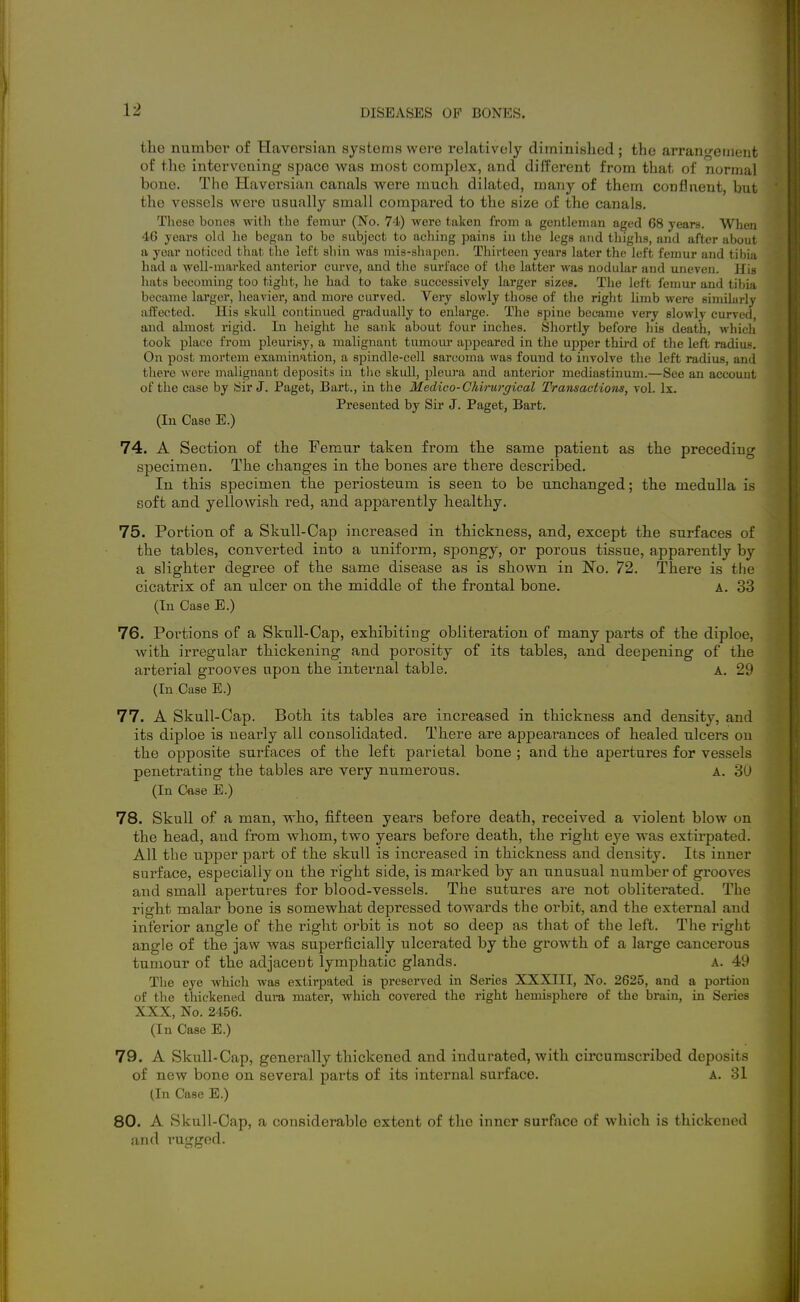 the number of Haversian systems were relatively diminished; the arrangement of the intervening siDace was most complex, and different from that of noruial bone. The Haversian canals were much dilated, many of them confluent, but the vessels were usually small compared to the size of the canals. These bones with the femur (No. 74) were taken from a gentleman aged 68 years. When 46 years old he began to be subject to aching pains in the legs and thighs, and after about a year noticed that the left shin was mis-shapen. Thirteen years later the left femur and tibia had a well-marked anterior curve, and the surface of tlie latter was nodular and uneven. Ifis hats becoming too tight, he had to take successively larger sizes. The left femur and tibia became lai'ger, heavier, and more curved. Very slowly those of the right limb were similarly affected. His skull continued gradually to enlarge. The spine became very slowly curved, and abnost rigid. In height he sank about four inches. Shortly before liis death, whicli took place from pleurisy, a malignant tumom* appeared in the upper thu-d of the left radiu.-. On post mortem examination, a spindle-cell sarcoma was found to involve the left radius, and there were malignant deposits in tlie skull, jjleiu-a and anterior mediastinum.—See an account of the case by .Sir J. Paget, Bart., in the Medico-Chirurgical Transactions, vol. Ix. Presented by Sir J. Paget, Bart. (In Case E.) 74. A Section of the Femur taken from the same patient as the preceding specimen. The changes in the bones are there described. In this specimen the periosteum is seen to be unchanged; the medulla i.- soft and yellowish red, and apparently healthy. 75. Portion of a Skull-Cap increased in thickness, and, except the surfaces of the tables, converted into a uniform, spongy, or porous tissue, apparently by a slighter degree of the same disease as is shown in No. 72. There is the cicatrix of an ulcer on the middle of the frontal bone. a. 33 (In Case E.) 76. Portions of a Skull-Cap, exhibiting obliteration of many parts of the diploe, Avith irregular thickening and porosity of its tables, and deepening of the arterial grooves upon the internal table. A. 29 (In Case E.) 77. A Skull-Cap. Both its tables are increased in thickness and density, and its diploe is nearly all consolidated. There are appearances of healed ulcers on the opposite surfaces of the left parietal bone ; and the apertures for vessels penetrating the tables are very numerous. A. 3U (In Cese E.) 78. Skull of a man, who, fifteen years before death, received a violent blow on the head, and from whom, two years before death, the right eye was extirpated. All the upper part of the skull is increased in thickness and density. Its inner surface, especially on the right side, is marked by an unusual number of grooves and small apertures for blood-vessels. The sutures are not obliterated. The right malar bone is somewhat depressed towards the orbit, and the external and interior angle of the i-ight orbit is not so deep as that of the left. The right angle of the jaw was superficially ulcerated by the growth of a large cancerous tumour of the adjacent lymphatic glands. A. 49 The eye which was extirpated is preserved in Series XXXIII, No. 2625, and a portion of tVie tliickened dura mater, which covered the right hemisphere of the brain, in Series XXX, No. 2456. (In Case E.) 79. A Skull-Cap, generally thickened and indurated, with circumscribed deposits of new bone on several parts of its internal surface. A. 31 (In Case E.) 80. A Skull-Cap, a considerable extent of the inner surface of which is thickened and rugged.