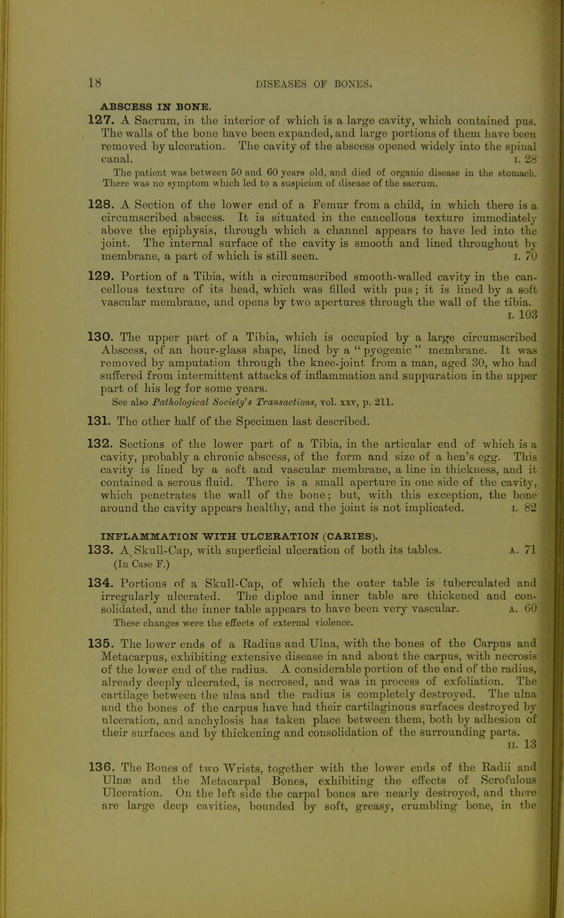 ABSCESS IN BONE. 127. A Sacrum, in the interior of which is a large cavity, which contained pus. The walls of the bone have been expanded, and large portions of them have been removed by ulceration. The cavity of the abscess opened widely into the spinal canal. i. 28 The patient was between 50 and 60 years old, and died of organic disease in the stomacli. There was no symptom which led to a suspicion of disease of the sacrum. 128. A Section of the lower end of a Femur from a child, in which there is a circumscribed abscess. It is situated in the cancellous texture immediately above the epiphysis, through which a channel appears to have led into the joint. The internal surface of the cavity is smooth and lined throughout by membrane, a part of which is still seen. I. 70 129. Portion of a Tibia, with a circumscribed smooth-walled cavity in the can- cellous texture of its head, which was filled with pus; it is lined by a soft vascular membrane, and opens by two apertures through the wall of the tibia, I. 103 130. The upper part of a Tibia, which is occupied by a large circumscribed Abscess, of an hour-glass shape, lined by a  pyogenic  membrane. It was removed by amputation through the knee-joint from a man, aged 30, who had suffered from intermittent attacks of inflammation and suppuration in the upper part of his leg for some years. See also Fathologieal Socieiy^s Transactions, vol. xxv, p. 211. 131. The other half of the Specimen last described. 132. Sections of the lower part of a Tibia, in the articular end of which is a cavity, probably a chronic abscess, of the form and size of a hen's egg. This cavity is lined by a soft and vascular membrane, a line in thickness, and it ^ contained a serous fluid. There is a small aperture in one side of the cavity, which penetrates the wall of the bone; but, with this exception, the bone around the cavity appears healthy, and the joint is not implicated. i. 82 INFLAMMATION WITH ULCBBATION (CARIES). 133. A. Skull-Cap, with superficial ulceration of both its tables. A. 71 (In Case F.) 134. Portions of a Skull-Cap, of which the outer table is tubcrculated and irregularly ulcerated. The diploe and inner table are thickened and con- solidated, and the inner table appears to have been very vascular, A. GO These changes were the effects of external Tiolence. 135. The lower ends of a Radius and Ulna, with the bones of the Carpus and Metacarpus, exhibiting extensive disease in and about the carpus, with necrosis of the lower end of the radius. A considerable portion of the end of the radius, already deeply ulcerated, is necrosed, and was in process of exfoliation. Tlu' cartilage between the ulna and the radius is completely destroyed. The uhi;i and the bones of the carpus have had their cartilaginous surfaces destroyed by ulceration, and anchylosis has taken place between them, both by adhesion of their surfaces and by thickening and consolidation of the surrounding parts. II. 13 136. The Bones of two Wrists, together with the lower ends of the Radii and Ulnse and the Metacarpal Bones, exhibiting the effects of Scrofulous Ulceration. On the left side the carpal bones are nearly destroyed, and there are large deep cavities, bounded by soft, greas}^ crumbling bone, in tlir
