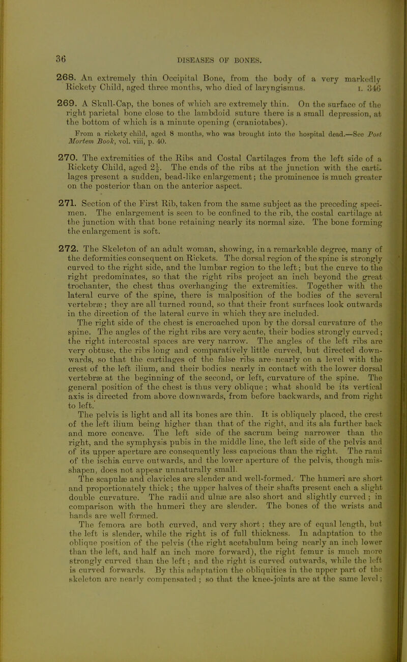 268. An extremely thin Occipital Bone, from the body of a very markerHy Rickety Chikl, aged three months, who died of laryngismus. i. 34G 269. A Skull-Cap, the bones of which are extremely thin. On the surface of the right parietal bone close to the lambdoid suture there is a small depression, at the bottom of which is a minute opening (craniotabes). From a rickety cliild, aged 8 months, who was brought into the hospital dead.—See Post Mortem Boole, vol. viii, p. 40. 270. The extremities of the Ribs and Costal Cartilages from the left side of a Rickety Child, aged 2|. The ends of the ribs at the junction with the carti- lages present a sudden, bead-like enlargement; the prominence is much greater on the posterio]' than on the anterior aspect. 271. Section of the First Rib, taken from the same subject as the preceding speci- men. The enlargement is seen to be confined to the rib, the costal cartilage at the junction with that bone retaining nearly its normal size. The bone forming the enlargement is soft. 272. The Skeleton of an adult woman, showing, in a remarkable degree, many of the deformities consequent on Rickets. The dorsal region of the spine is strongly curved to the right side, and the lumbar region to the left; but the curve to the right predominates, so that the right ribs project an inch beyond the great trochanter, the chest thus overhanging the extremities. Together with the lateral curve of the spine, there is malposition of the bodies of the several vertebrae; they are all turned round, so that their front surfaces look outwards in the direction of the lateral curve in which they are included. The right side of the chest is encroached upon by the dorsal curvature of th^ spine. The angles of the right ribs are very acute, their bodies strongly curved; the right intercostal spaces are very narrow. The angles of the left ribs are very obtuse, the ribs long and comparatively little curved, but directed down- wards, so that the cartilages of the false ribs are nearly on a level with the crest of the left ilium, and their bodies nearly in contact with the lower dorsal vertebrae at the beginning of the second, or left, curvature of the spine. The general position of the chest is thus very oblique ; what should be its vertical axis is directed from a,bove downwards, from before backwards, and from right to left. The pelvis is light and all its bones are thin. It is obliquely placed, the crest of the left ilium being higher than that of the right, and its ala further back and more concave. The left side of the sacrum being narrower than the right, and the symphysis pubis in the middle line, the left side of the pelvis and of its upper aperture are consequently less capacious than the right. The rami of the ischia curve outwards, and the lower aperture of the pelvis, though mis- shapen, does not appear unnaturally small. The scapulae and clavicles are slender and well-formed. The humeri are short and proportionately thick ; the upper halves of their shafts present each a slight double curvature. The radii and ulna3 are also short and slightly curved ; in comparison with the humeri they are slender. The bones of the wrists and hands are well formed. The femora are both curved, and very short; they are of equal length, but the left is slender, while the right is of full thickness. In adaptation to the oblique position of the pelvis (<he right acetabulum being nearly an inch lower than the left, and half an inch more forward), the right femur is much more strongly curved than the left; and the right is curved outwards, while the loft is curved forwards. By this adaptation the obliquities in the upper part of the skeleton are nearly compensated ; so that the knee-joints are at the same level;