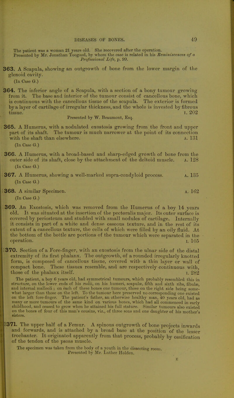 The patient was a woman 21 years old. She recovered after the operation. Presented by Mr. Jonathan Toogood, by whom the case is related in his Beminiscences of a Professional Life, p. 99. 363. A Scapula, showing an outgrowth of bone from the lower margin of the glenoid cavity. (In Case a.) 364. The inferior angle of a Scapula, with a section of a bony tumour growing from it. The base and interior of the tumour consist of cancellous bone, which is continuous with the cancellous tissue of the scapula. The exterior is formed by a layer of cartilage of irregular thickness, and the whole is invested by fibrous tissue. I. 202 Presented by W. Beaumont, Esq. 365. A Humerus, with a nodulated exostosis growing from the front and upper part of its shaft. The tumour is much narrower at the point of its connection with the shaft than elsewhere. a. 131 (In Case Gc.) 366. A Humerus, with a broad-based and sharp-edged growth of bone from the outer side of its shaft, close by the attachment of the deltoid muscle. A. 128 (In Case G.) 367. A Humerus, showing a well-marked supra-condyloid process. A. 135 (In Case G-.) i 368. A similar Specimen. A. 162 (In Case Q.) 369. An Exostosis, which was removed from the Humerus of a boy 14 years old. It was situated at the insertion of the pectoralis major. Its outer surface is covered by periosteum and studded with small nodules of cartilage. Internally it consists in part of a white and dense osseous texture, and in the rest of its extent of a cancellous texture, the cells of which were filled by an oily fluid. At the bottom of the bottle are portions of the tumour which were separated in the operation. i. 105 1370. Section of a Fore-finger, with an exostosis from the ulnar side of the distal extremity of its first phalanx. The outgrowth, of a rounded irregularly knotted form, is composed of cancellous tissue, covered with a thin layer or wall of compact bone. These tissues resemble, and are respectively continuous with, those of the phalanx itself. i. 282 The patient, a boy 6 years old, had symmetrical tumours, which probably resembled this in structure, on the lower ends of his radii, on his humeri, scapulae, fifth and sixth ribs, fibulce, and internal malleoli; on each of these bones one tumour, those on the right side being some- what larger than those on the left. To the tumour here preseryed no corresponding one existed on the left fore-finger. The patient's father, an otherwise healthy man, 40 years old, had as many or more tumours of the same kind on various bones, which had all commenced in early childhood, and ceased to grow when ho attained his fuU stature. Similar tumours also existed on the bones of four of this man's cousins, viz., of three sons and one daughter of his mother's sisters. 371. The upper half of a Femur. A spinous outgrowth of bone projects inwards and forwards, and is attached by a broad base at the position of the lesser trochanter. It originated apparently from that process, probably by ossification of the tendon of the psoas muscle. The specimen was taken from the body of a youth in the dissecting room. Presented by Mr. Luther Holdon.