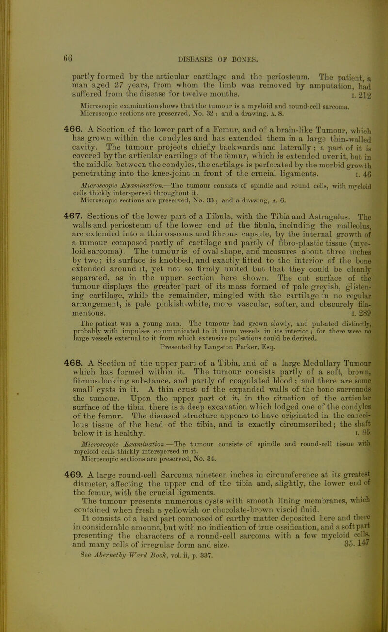 partly formed by tlio articular cartilage and the periosteum. The patient a man aged 27 years, from whom the limb was removed by amputation, had suffered from the disease for twelve months. i. 212 Microscopic examination shows that the tumour is a myeloid and round-cell sarcoma. Microscopic sections are preserved, No. 32 ; and a di-awing, A. 8. 466. A Section of the lower part of a Femur, and of a brain-like Tumour, which has grown within the condyles and has extended them in a large thin-walled cavity. The tumour projects chiefly backwards and laterally; a part of it is covered by the articular cartilage of the femur, which is extended over it, but in the middle, between the condyles, the cartilage is perforated by the morbid growth penetrating into the knee-joint in front of the crucial ligaments. i. 46 Microscopic ^Examination.—The tumour consists of spindle and round cells, with myeloid cells thickly interspersed throughout it. Microscopic sections are preserved, No. 33 ; and a drawing, a. 6. 467. Sections of the lower part of a Fibula, with the Tibia and Astragalus. The walls and periosteum of the lower end of the fibula, including the malleolus, are extended into a thin osseous and fibrous capsule, by the internal growth of a tumour composed partly of cartilage and partly of fibro-plastic tissue (mye- loid sarcoma). The tumour is of oval shape, and measures about three inches by two; its surface is knobbed, mid exactly fitted to the interior of the bone extended around it, yet not so firmly united but that they could be cleanly separated, as in the upper section here shown. The cut surface of the tumour displays the greater part of its mass formed of pale greyish, glisten- ing cartilage, while the remainder, mingled with the cartilage in no regular arrangement, is pale pinkish-white, more vascular, softer, and obscurely fila- mentous. I. 289 The patient was a young man. The tumour had grown slowly, and pulsated distmctly, probably with impulses communicated to it irom vessels in its interior ; for there were no large vessels external to it from which extensive pulsations could be derived. Presented by Langston Parker, Esq. 468. A Section of the upper part of a Tibia, and of a large Medullary Tumour which has formed within it. The tumour consists partly of a soft, brown, fibrous-looking substance, and partly of coagulated blood; and there are some small cysts in it. A thin crust of the expanded walls of the bone surrounds the tumour. Upon the upper part of it, in the situation of the articular surface of the tibia, there is a deep excavation which lodged one of the condyles of the femur. The diseased structure appears to have originated in the cancel- lous tissue of the head of the tibia, and is exactly circumscribed; the shaft below it is healthy. i. 85 Microscopic Examination.—The tumour consists of spindle and round-cell tissue ydt)i myeloid cells thickly interspersed in it. Microscopic sections are preserved, No. 34. 469. A large round-cell Sarcoma nineteen inches in circumference at its greatest diameter, affecting the upper end of the tibia and, slightly, the lower end of the femur, with the crucial ligaments. The tumour presents numerous cysts wdth smooth lining membranes, which contained when fresh a yellowish or chocolate-brown viscid fluid. It consists of a hard part composed of earthy matter deposited here and there in considerable amount, but with no indication of true ossification, and a soft part presenting the characters of a round-cell sarcoma with a few myeloid cells, and many cells of irregular form and size. 35. 147 See Aberneihy Ward BooJc, vol. ii, p. 337.