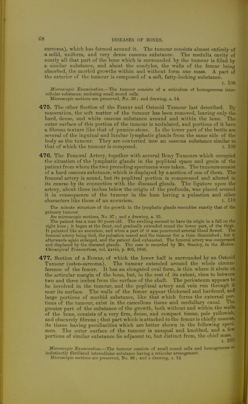 G8 sarcoina), which has formed around it. The tumour consists almost entirely of a solid, uniform, and very dense osseous substance. The medulla cavity of nearly all that part of the bone which is surrounded by the tumour is filled by a similar substance, and about the condyles, the walls of the femur being absorbed, the morbid growths within and without form one mass. A part of the exterior of the tumour is composed of a soft, fatty-looking substance. I. 108 Microscopic Examination.—The tumour consists of a reticulum of homogeneous inter- celUilai' substauce, enclosing small round cells. Mici'oscopic sections are preserved, No. 36 ; and drawing, A. 14. 475. The other Section of the Femur and Osteoid Tumour last described. By maceration, the soft matter of the tumour has been removed, leaving only the hard, dense, and white osseous substance around and within the bone. The outer surface of this portion of the tumour is nodulated, and portions of it liave a fihrous texture like that of pumice-stone. In the lower part of the bottle are several of the inguinal and lumbar lymphatic glands from the same side of the body as the tumour. They are converted into an osseous substance similar to that of which the tumour is composed. i. 109 476. The Femoral Artery, together with several Bony Tumours which occupied the situation of the lymphatic glands in the popliteal space and groin of the patient from whom the two preceding specimens were taken. The tumours consist of a hard osseous substance, which is displayed by a section of one of them. The femoral artery is sound, but its popliteal portion is compressed and altered in its course by its connection with the diseased glands. The ligature upon the artery, about three inches below the origin of the profunda, was placed arouud it in consequence of the tumour in the ham having a pulsation and other characters like those of an aneurism. i. 110 The minute structure of the gi-owth in the lymphatic glands resembles exactly that of the primary tumour. See microscopic sections, No. 37; and a drawing, A. 15. The patient was a man 30 years old. The swelling seemed to have its origin in a fall on the right knee ; it began at the front, and gradually extended round the lower part, of the thigh. It pxilsated like an aneurism, and when a part of it was punctvu-ed arterial blood flowed. The femoral artery being tied, the pulsation ceased and the tumour for a time diminished; but it afterwards again enlarged, and the patient died exhausted. The femoral artery was compressed and displaced by the diseased glands, The case is recorded by Mr. Stanley, in the Medico- Chirurgical Transactions, vol. xxviii, p. 305, 1845. 477. Section of a Femur, of which the lower half is surrounded by an Osteoid Tumour (osteo-sarcoma). The tumour extended around the whole circum- ference of the femur. It has an elongated oval form, is thin where it abuts on the articular margin of the bone, but, in the rest of its extent, rises to between two and three inches from the surface of the shaft. The periosteum appears to be involved in the tumour, and the popliteal artery and vein run through it near its surface. The walls of the femur appear thickened and hardened, and large portions of morbid substance, like that which forms the external por- tions of the tumour, exist in the cancellous tissue and medullary canal. The greater part of the substance of the growth, both without and within the walls of the bone, consists of a very firm, dense, and compact tissue, pale yellowish, and obscurely fibrous ; that part which is attached to the femur is chiefly osseous, its tissue having peculiarities which are better shown in the following speci- men. The outer surface of the tumour is unequal and knobbed, and a few portions of similar substance lie adjacent to, but distinct from, the chief -^^^gf) Microscopic Usamijiaiion.—The tumour consists of small round cells and homogeneous or indistinctly fibrillated intercellular substance having a reticular arrangement. Microscopic sections are preserved. No. 38; and a drawing, A. 12.