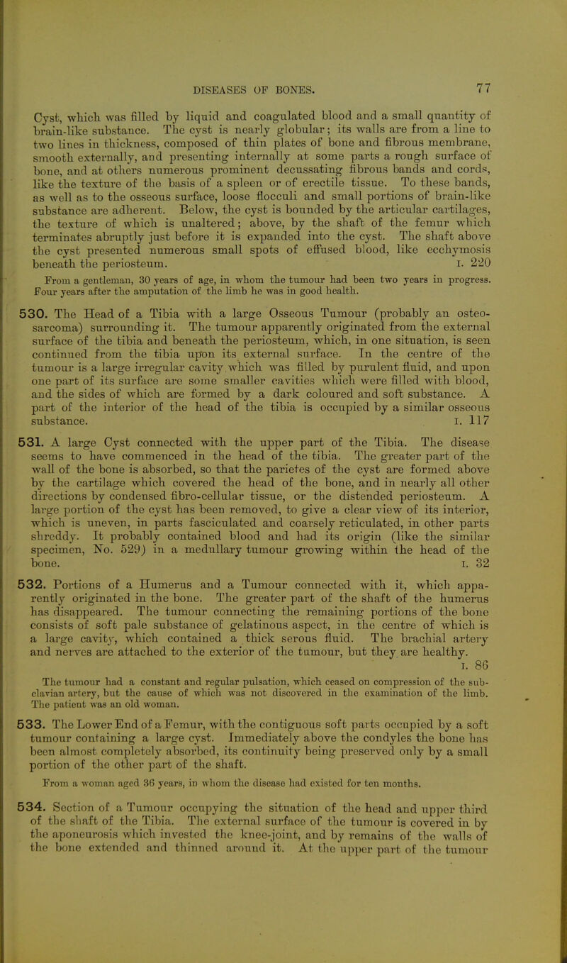 Cyst, whicli was filled by liquid and coagulated blood and a small quantity of brain-like substance. The cyst is nearly globular; its walls are from a line to two lines in thickness, composed of thin plates of bone and fibrous membrane, smooth externally, and presenting internally at some parts a rough surface of bone, and at others numerous prominent decussating fibrous bands and cords, like the texture of the basis of a spleen or of erectile tissue. To these bands, as well as to the osseous surface, loose flocculi and small portions of brain-like substance are adherent. Below, the cyst is bounded by the articular cartilages, the texture of which is unaltered; above, by the shaft of the femur which terminates abruptly just before it is expanded into the cyst. The shaft above the cyst presented numerous small spots of effused blood, like ecchymosis beneath the periosteum. i. 220 From a gentleman, 30 years of age, in whom the tumour had been two years in progress. Foiu' years after the amputation of the limb he was in good health. 530. The Head of a Tibia with a large Osseous Tumour (probably an osteo- sarcoma) surrounding it. The tumour apparently originated from the external surface of the tibia and beneath the periosteum, which, in one situation, is seen continued from the tibia upon its external surface. In the centre of the tumour is a large irregular cavity , which was filled by purulent fluid, and upon one part of its surface are some smaller cavities which were filled with blood, and the sides of which are formed by a dark coloured and soft substance. A part of the interior of the head of the tibia is occupied by a similar osseous substance. i. 117 531. A large Cyst connected with the upper part of the Tibia. The disease seems to have commenced in the head of the tibia. The greater part of the wall of the bone is absorbed, so that the parietes of the cyst are formed above by the cartilage which covered the head of the bone, and in nearly all other directions by condensed fibro-cellular tissue, or the distended periosteum. A large portion of the cyst has been removed, to give a clear view of its interior, which is uneven, in parts fasciculated and coarsely reticulated, in other parts shreddy. It probably contained blood and had its origin (like the similar specimen, No. 529) in a medullary tumour growing within the head of the bone. I. 32 532. Portions of a Humerus and a Tumour connected with it, which appa- rently originated in the bone. The greater part of the shaft of the humerus has disappeared. The tumour connecting the remaining portions of the bone consists of soft pale substance of gelatinous aspect, in the centre of which is a large cavitj-, which contained a thick serous fluid. The brachial artery and nerves are attached to the exterior of the tumour, but they are healthy. I. 86 The tumour had a constant and regidar pulsation, which ceased on compression of the sub- clavian artery, but the caiise of wliich was not discovered in the examination of the limb. The patient was an old woman. 533. The Lower End of a Femur, with the contiguous soft parts occupied by a soft tumour containing a large cyst. Immediately above the condyles the bone has been almost completely absorbed, its continuity being preserved only by a small portion of the other part of the shaft. From a woman aged 36 years, in whom the disease had existed for ten months. 534. Section of a Tumour occupying the situation of the head and upper third of the shaft of the Tibia. The external surface of the tumour is covered in by the aponeurosis which invested the knee-joint, and by remains of the walls of the bone extendrd and thinnrd around it. At the upper part of the tumour