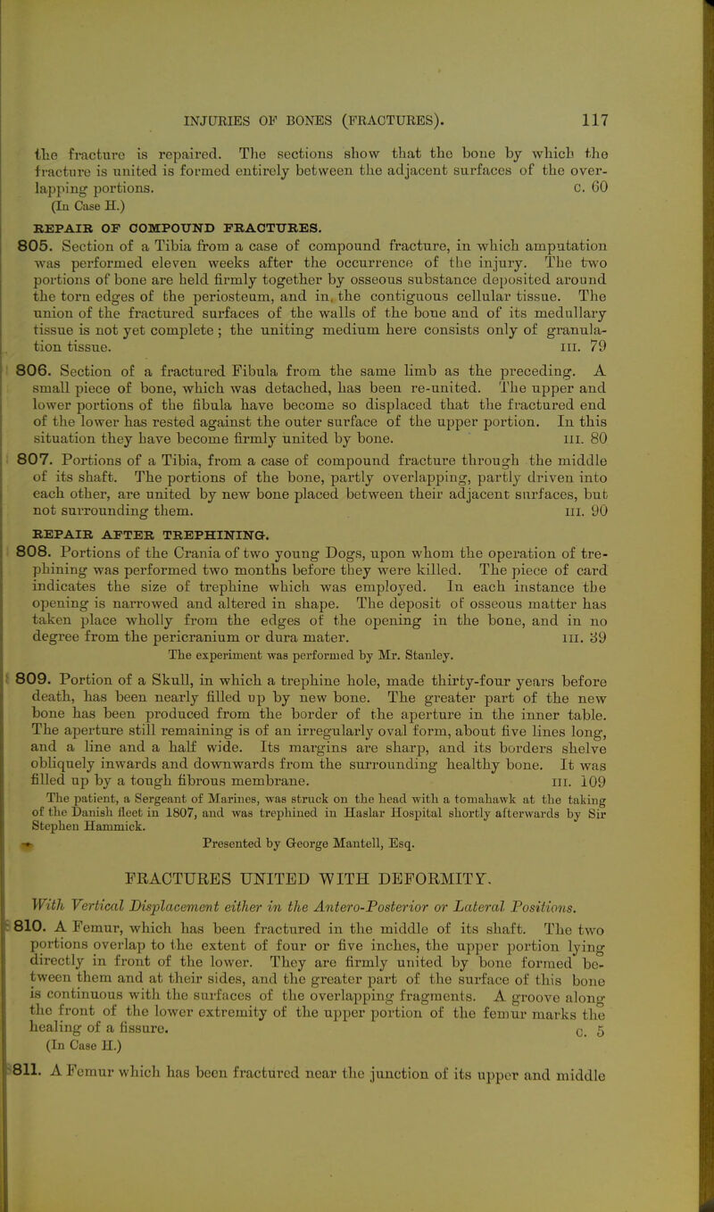 tlie fracture is repaired. Tlae sections show that the bone hy wliicb the fracture is united is formed entirely between the adjacent surfaces of the over- lapping portions. C. 60 (In Case H.) BEPAIR OF COMPOUND FRACTURES. 805. Section of a Tibia from a case of compound fracture, in which amputation was performed eleven weeks after the occurrence of the injury. The two portions of bone are held firmly together by osseous substance deposited around the torn edges of the periosteum, and in, the contiguous cellular tissue. The union of the fractured surfaces of the walls of the bone and of its medullary tissue is not yet complete; the uniting medium here consists only of granula- tion tissue. III. 79 806. Section of a fractured Fibula from the same limb as the preceding. A small piece of bone, which was detached, has been re-united. The upper and lower portions of the fibula have become so displaced that the fractured end of the lower has rested against the outer surface of the upper portion. In this situation they have become firmly united by bone. ill. 80 I 807. Portions of a Tibia, from a case of compound fracture through the middle of its shaft. The portions of the bone, partly overlapping, partly driven into each other, are united by new bone placed between their adjacent surfaces, but not surrounding them. ill. 90 REPAIR AFTER TREPHINING. ! 808. Portions of the Crania of two young Dogs, upon whom the operation of tre- phining was performed two months before they were killed. The piece of card indicates the size of ti'ephine which was employed. In each instance the opening is narrowed and altered in shape. The deposit of osseous matter has taken place wholly from the edges of the opening in the bone, and in no degree from the pericranium or dura mater. iii. 89 The experiment was performed by Mr. Stanley. i 809. Portion of a Skull, in which a trephine hole, made thirty-four years before death, has been nearly filled up by new bone. The greater part of the new bone has been produced from the border of the aperture in the inner table. The aperture still remaining is of an irregularly oval form, about five lines long, and a line and a half wide. Its margins are sharp, and its borders shelve obliquely inwards and downwards from the surrounding healthy bone. It was filled up by a tough fibrous membrane. iii. 109 The patient, a Sergeant of Marines, was struck on the head with a tomahawk at the taking of the Danish fleet in 1807, and was trephined in Haslar Hosj)ital shortly afterwards by Sir Stephen Hammick. Presented by G-eorge Mantell, Esq. FRACTURES UNITED WITH DEFORMITT. With Vertical Displacement either in the Antero-Posterior or Lateral Positions. S 810. A Femur, which has been fractured in the middle of its shaft. The two portions overlap to the extent of four or five inches, the upper portion lying directly in front of the lower. They are firmly united by bone formed be- tween them and at their sides, and the greater part of the surface of this bone is continuous with the surfaces of the overlapping fragments. A groove alono* the front of the lower extremity of the upper portion of the femur marks the healing of a fissure. c_ 5 (In Case H.) ^811. A Femur which has been fractured near the junction of its upper and middle