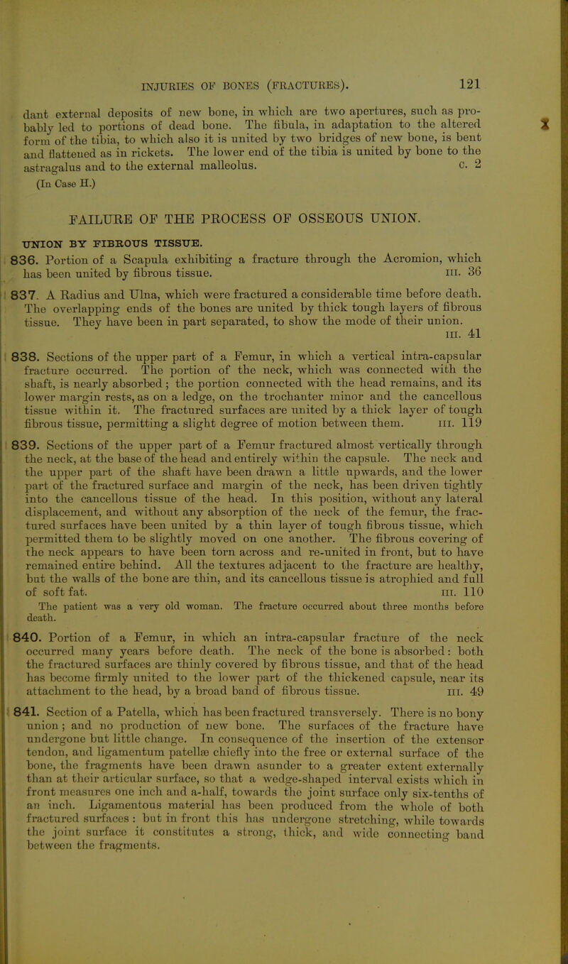 dant external deposits of new bone, in whicli are two apertures, sucli as pro- bably led to portions of dead bone. The fibula, in adaptation to the altered form of the tibia, to which also it is united by two bridges of new bone, is bent and flattened as in rickets. The lower end of the tibia is united by bone to the astragalus and to the external malleolus. c. 2 (In Case H.) TAILURE OF THE PROCESS OF OSSEOUS UNION. UNION BY FIBROUS TISSUE. 836. Portion of a Scapula exhibiting a fracture through the Acromion, which has been united by fibrous tissue. m. 36 837. A Radius and Ulna, which were fractured a considerable time before death. The overlapping ends of the bones are united by thick tough layers of fibrous tissue. They have been in part separated, to show the mode of their union. III. 41 838. Sections of the upper part of a Femur, in which a vertical intra-capsular fracture occurred. The portion of the neck, which was connected with the shaft, is nearly absorbed ; the portion connected with the head remains, and its lower margin rests, as on a ledge, on the trochanter minor and the cancellous tissue within it. The fractured surfaces are united by a thick layer of tough fibrous tissue, permitting a slight degree of motion between them. iii. 119 839. Sections of the upper part of a Femur fractured almost vertically through the neck, at the base of the head and entirely within the capsule. The neck and the upper part of the shaft have been drawn a little upwards, and the lower part of the fractured surface and margin of the neck, has been driven tightly into the cancellous tissue of the head. In this position, without any lateral displacement, and withoiit any absorption of the neck of the femur, the frac- tured surfaces have been united by a thin layer of tough fibrous tissue, which permitted them to be slightly moved on one another. The fibrous covering of the neck appears to have been torn across and re-united in front, but to have remained entire behind. All the textures adjacent to the fracture are healthy, but the walls of the bone are thin, and its cancellous tissue is atrophied and full of soft fat. III. 110 The patient was a very old woman. The fracture occurred about three months before death. 840. Portion of a Femur, in which an intra-capsular fracture of the neck occurred many years before death. The neck of the bone is absorbed: both the fractured surfaces are thinly covered by fibrous tissue, and that of the head has become firmly united to the lower part of the thickened capsule, near its attachment to the head, by a broad band of fibrous tissue. iii. 49 841. Section of a Patella, which has been fi'actured transversely. There is no bony union ; and no production of new bone. The surfaces of the fracture have undergone but little change. In consequence of the insertion of the extensor tendon, and ligamentum patellse chiefly into the free or external surface of the bone, the fragments have been drawn asunder to a greater extent externally than at their articular surface, so that a wedge-shaped interval exists which in front measures one inch and a-haK, towards the joint surface only six-tenths of an inch. Ligamentous material has been produced from the whole of both fractured surfaces : but in front this has undergone sti'etching, while towards the joint surface it constitutes a strong, thick, and wide connecting band between the fragments.