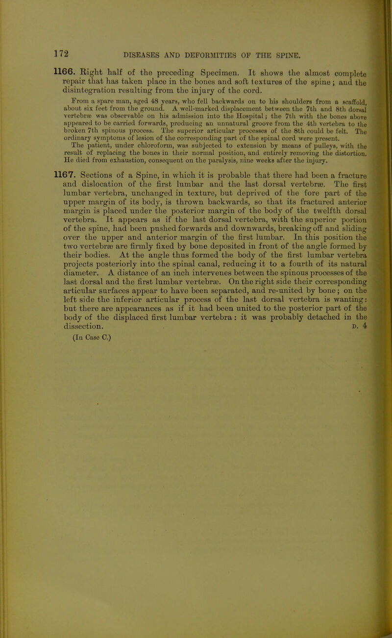 1166. Right half of the preceding Specimen. It shows the almost complete repair that has taken place in the bones and soft textures of the spine; and the disintegration resulting from the injury of the cord. From a spare man, aged 48 years, wlio fell backwards on to his shoulders from a scaffold, about six feet from the ground. A well-marked displacement between the 7tli and 8tli dorsal vertebras was observable on his admission into the Hospital; the 7th with the bones above- appeared to be carried forwards, producing an unnatural groove from the 4th vertebra to tlie broken 7th spinous process. The superior articular processes of the 8th could be felt. The ordinary symptoms of lesion of the corresponding part of the sjjinal cord were present. The patient, under chloroform, was subjected to extension by means of pulleys, with the result of replacing the bones in their normal position, and entirely removing the distortion. He died from exhaustion, consequent on the jjaralysis, nine weeks after the injury. 1167. Sections of a Spine, in which it is probable that there had been a fracture and dislocation of the first himbar and the last dorsal vertebrae. The first lumbar vertebra, unchanged in texture, but deprived of the fore part of the upper margin of its body, is thrown backwards, so that its fractured anterior margin is placed under the posterior margin of the body of the twelfth dorsal vertebra. It appears as if the last dorsal vertebra, with the superior portion of the spine, had been pushed forwards and downwards, breaking off and sliding over the upper and anterior margin of the first lumbar. In this position the two vertebrae are firmly fixed by bone deposited in front of the angle formed by their bodies. At the angle thus formed the body of the first lumbar vertebra projects posteriorly into the spinal canal, reducing it to a fourth of its natural diameter. A distance of an inch intervenes between the spinous processes of the last dorsal and the first lumbar vertebrsB. On the right side their corresponding articular surfaces appear to have been separated, and re-united by bone; on the left side the inferior articular process of the last dorsal vertebra is wanting: but there are appearances as if it had been united to the posterior part of the body of the displaced first lumbar vertebra : it was probably detached in the dissection. D. 4 (la Case C.)