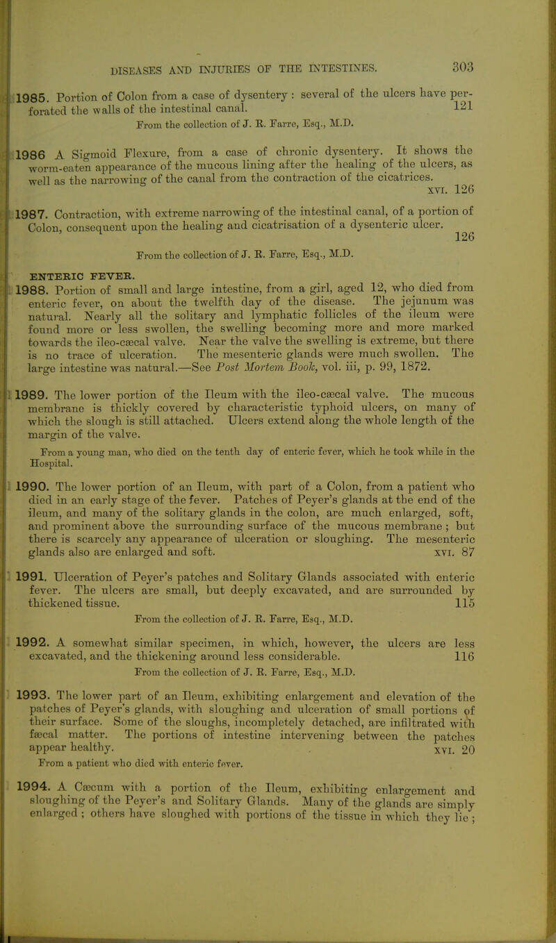 1985. Portion of Colon from a case of dysentery : several of the ulcers have per- forated the walls of the intestinal canal. 121 From the collection of J. E. Farre, Esq., M.D. 1986 A Sigmoid Flexure, from a case of chronic dysentery. It shows the worm-eaten appearance of the mucous lining after the healing of the ulcers, as well as the narrowing of the canal from the contraction of the cicatrices. XVI. 126 1987. Contraction, with extreme narrowing of the intestinal canal, of a portion of Colon consequent upon the healing and cicatrisation of a dysenteric ulcer. ^ 126 From the collection of J. E. Farre, Esq., M.D. ENTERIC FEVER. 1988. Portion of small and large intestine, from a girl, aged 12, who died from enteric fever, on ahout the twelfth day of the disease. The jejunum was natui-al. Nearly all the solitary and lymphatic follicles of the ileum were found more or less swollen, the swelling becoming more and more marked towards the ileo-csecal valve. Near the valve the swelling is extreme, but there is no trace of ulceration. The mesenteric glands were much swollen. The large intestine was natural.—See Post Mortem Booh, vol. iii, p. 99, 1872. 1989. The lower portion of the Ileum with the ileo-caecal valve. The mucous membrane is thickly covered by characteristic typhoid ulcers, on many of which the slough is still attached. Ulcers extend along the whole length of the margin of the valve. From a young man, who died on the tenth day of enteric fever, which he took while in the Hospital. 1990. The lower portion of an Ileum, with part of a Colon, from a patient who died in an early stage of the fever. Patches of Peyer's glands at the end of the ileum, and many of the solitary glands in the colon, are much enlarged, soft, and prominent above the surrounding surface of the mucous membrane ; but there is scarcely any appearance of ulceration or sloughing. The mesenteric glands also are enlarged and soft. xvi. 87 1991. Ulceration of Peyer's patches and Solitary Glands associated with enteric fever. The ulcers are small, but deeply excavated, and are surrounded by thickened tissue. 115 IVom the collection of J. E. Farre, Esq., M.D. 1992. A somewhat similar specimen, in which, however, the ulcers are less excavated, and the thickening around less considerable. 116 From the collection of J. E. Farre, Esq., M.D. 1993. The lower part of an Ileum, exhibiting enlargement and elevation of the patches of Peyer's glands, with sloughing and ulceration of small portions of their surface. Some of the sloughs, incompletely detached, are infiltrated witli fsecal matter. The portions of intestine intervening between the patches appear healthy. xvi. 20 From a patient who died with enteric fever. 1994. A CaBcum with a portion of the Ileum, exhibiting enlargement and sloughing of the Peyer's and Solitary Glands. Many of the glands are simply enlarged ; others have sloughed with portions of the tissue in which they lie ;