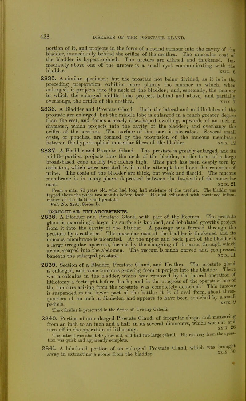 portion of it, and projects in the form of a round tumour into the cavity of tho bladder, immediately behind the orifice of the urethra. The muscular coat of the bladder is hypertrophied. The ureters are dilated and thickened. Im- mediately above one of the ureters is a small cyst communicating with the bladder. xxix. 6 2835. A similar specimen; but the prostate not being divided, as it is in the preceding preparation, exhibits more plainly the manner in which, when enlarged, it projects into the neck of the bladder; and, especially, the manner in which the enlarged middle lobe projects behind and above, and partially overhangs, the orifice of the urethra. xxix. 7 2836. A Bladder and Prostate Grland. Both the lateral and middle lobes of the prostate are enlarged, but the middle lobe is enlarged in a much greater degree than the rest, and forms a nearly disc-shaped swelling, upwards of an inch in diameter, which projects into the cavity of the bladder; and overhangs the orifice of the urethra. The surface of this part is ulcerated. Several small cysts, or pouches, are formed by the protrusion of the mucous membrane between the hypertrophied muscular fibres of the bladder. xxix. 12 2837. A Bladder and Prostate Gland. The prostate is greatly enlarged, and its middle portion projects into the neck of the bladder, in the form of a large broad-based cone nearly two inches high. This part has been deeply torn by catheters, which were arrested by it in the attempt to relieve the retention of urine. The coats of the bladder are thick, but weak and flaccid. The mucous membrane is in many places depressed between the fasciculi of the muscular coat. XXIX. 21 From a man, 70 years old, who had long had stricture of the urethi'a. The bladder was tapped above the pubes two months before death. He died exhausted with continued mflam- mation of the bladder and prostate. Vide No. 3291, Series L. IBREGTJLAB, ENLARGEMENTS. 2838. A Bladder and Prostate Gland, with part of the Rectum. The prostate gland is exceedingly large, its surface is knobbed, and lobulated growths project from it into the cavity of the bladder. A passage was formed through the prostate by a catheter. The muscular coat of the bladder is thickened and its mucous membrane is ulcerated. At the upper and back part of the bladder is a large irregular aperture, formed by the sloughing of its coats, through which nrine escaped into the abdomen. The rectum is much curved and compressed beneath the enlarged prostate. xxix. 11 2839. Section of a Bladder, Prostate Gland, and Urethra. The prostate gland is enlarged, and some tumours growing from it project into the bladder. There was a calculus in the bladder, which was removed by the lateral operation of lithotomy a fortnight before death; and in the progress of the operation one ot the tumours arising from the prostate was completely detached. This tumour is suspended in the lower part of the bottle ; it is of oval form, about three- quarters of an inch in diameter, and appears to have been attached by a small pedicle. xxi:^. y The calculus is preserved in the Series of Urinary Calculi. 2840. Portion of an enlarged Prostate Gland, of irregular shape, and measurmg from an inch to an inch and a half in its several diameters, which was cut and torn off in the operation of lithotomy. The patient was about 40 years old, and had two large calculi. His recovery from the opera- tion was quick and apparently complete. 2841. A lobulated portion of an enlarged Prostate Gland, which was brought away in extracting a stone from the bladder. xxix. o