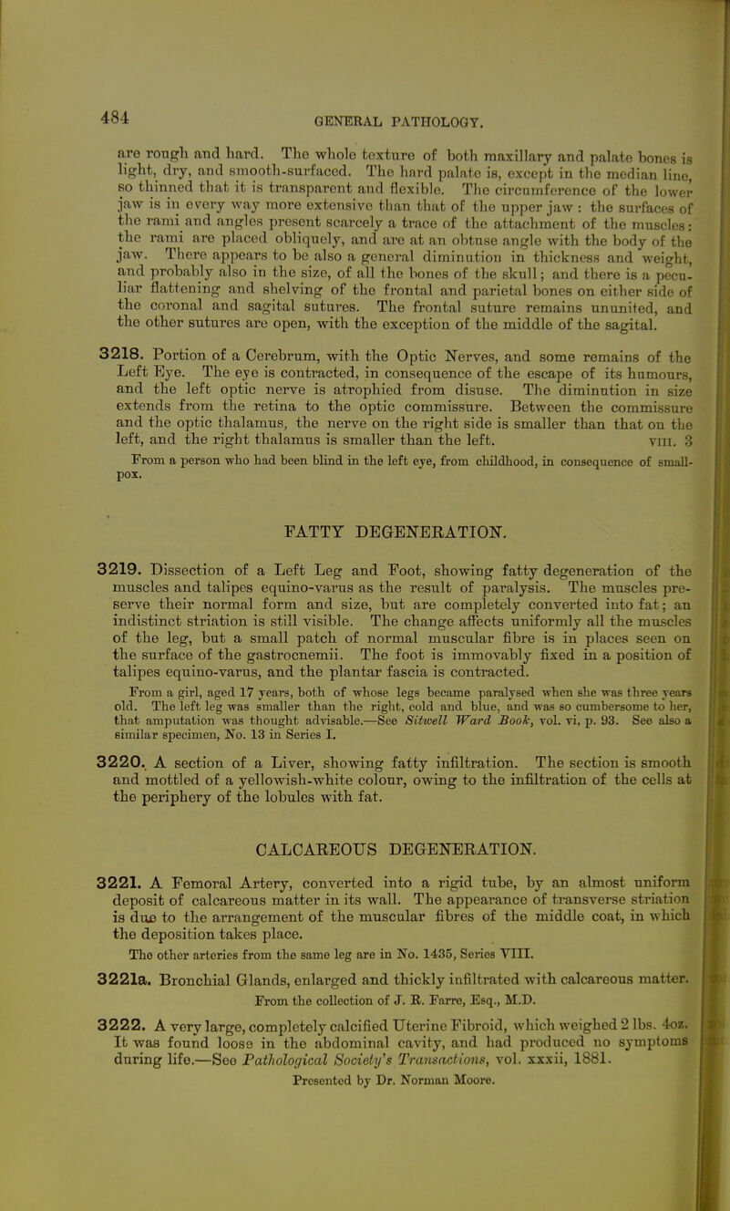 are rough and hard. The whole texture of both maxillary and palate bones is light, dry, and smooth-surfaced. The hard palate is, except in the median line, so thinned that it is transparent and flexible. The circumference of the lower jaw is in ev^ery way more extensive than that of the upper jaw : the surfaces of the rami and angles present scarcely a trace of the attachment of the muscles: the rami are placed obliquely, and are at an obtuse angle with the body of the jaw. There appears to be also a general diminution in thickness and weight, and probably also in the size, of all the bones of the skull; and there is a pecu- liar flattening and shelving of the frontal and parietal bones on either side of the coronal and sagital sutures. The frontal suture remains ununited, and the other sutures are open, with the exception of the middle of the sagital. 3218. Portion of a Cerebrum, with the Optic Nerves, and some remains of the Left Eye. The eye is contracted, in consequence of the escape of its humours, and the left optic nerve is atrophied from disuse. The diminution in size extends from the retina to the optic commissure. Between the commissure and the optic thalamus, the nerve on the right side is smaller than that on the left, and the right thalamus is smaller than the left. viii. 3 From a person who had been blind in the left eye, from childhood, in consequence of small- pox. FATTY DEGENERATION. 3219. Dissection of a Left Leg and Foot, showing fatty degeneration of the muscles and talipes equino-varus as the result of paralysis. The muscles pre- serve their normal form and size, but are completely converted into fat; an indistinct striation is still visible. The change afiects uniformly all the muscles of the leg, but a small patch of normal muscular fibre is in places seen on the surface of the gastrocnemii. The foot is immovably fixed in a position of talipes equino-varus, and the plantar fascia is contracted. From a girl, aged 17 years, both of whose legs became paralysed when she was three years old. The left leg was smaller than the right, cold and blue, and was so cumbersome to her, that amputation was thought adyisable.—See Sitwell Ward Booh, toI. vi, p. 93. See also a similar specimen. No. 13 in Series I. 3220. A section of a Liver, showing fatty infiltration. The section is smooth and mottled of a yellowish-white colour, owing to the infiltration of the cells at the periphery of the lobules with fat. CALCAREOUS DEGENERATION. 3221. A Femoral Artery, converted into a rigid tube, by an almost uniform deposit of calcareous matter in its wall. The appearance of transverse striation is due to the arrangement of the muscular fibres of the middle coat, in which the deposition takes place. The other arteries from the same leg are in No. 1435, Series VIII. 3221a. Bronchial Glands, enlarged and thickly infiltrated with calcareous matter. From the collection of J. R. Farre, Esq., M.D. 3222. A very large, completely calcified Uterine Fibroid, which weighed 2 lbs. 4oz. It was found loose in the abdominal cavity, and had produced no symptoms during life.—See PatJiological Society's Transactions, vol. xxxii, 1881. Presented by Dr. Norman Moore.