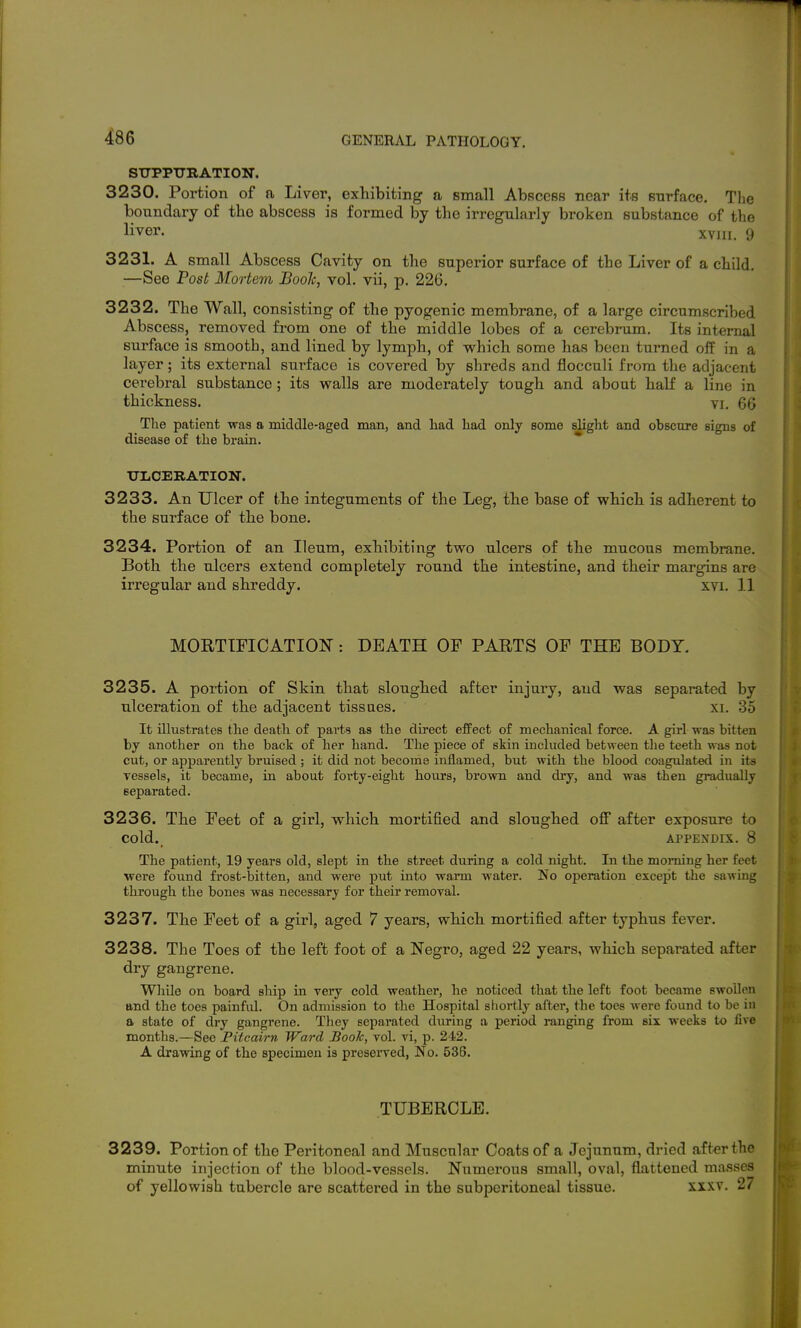 SUPPURATION. 3230. Portion of a Liver, exhibiting a small AbsccBS near its snrface, Tlie boundary of the abscess is formed by the irregularly broken substance of the liver. XVIII. 9 3231. A small Abscess Cavity on the superior surface of the Liver of a child. —See Post Mortem Boole, vol. vii, p. 226. 3232. The Wall, consisting of the pyogenic membrane, of a large circumscribed Abscess, removed fi-om one of the middle lobes of a cerebrum. Its internal surface is smooth, and lined by lymph, of vrhich some has been turaed off in a layer; its external surface is covered by shreds and flocculi from the adjacent cerebral substance; its walls are moderately tough and about half a line in thickness. vi. 66 The patient was a middle-aged man, and had had only some slight and obscure signs of disease of the brain. UliCERATION. 3233. An Ulcer of the integuments of the Leg, the base of which is adherent to the surface of the bone. 3234. Portion of an Ileum, exhibiting two ulcers of the mucous membrane. Both the ulcers extend completely round the intestine, and their margins are irregular and shreddy. xvi. 11 MORTIFICATION: DEATH OF PARTS OF THE BODY. 3235. A portion of Skin that sloughed after injury, and was separated by ulceration of the adjacent tissues. xi. 35 It illustrates the death of parts as the direct efPect of mechanical force. A girl was bitten by another on the back of her hand. The piece of skin included between the teeth was not cut, or apparently bruised; it did not become inflamed, but with the blood coagulated in its vessels, it became, in about forty-eight hours, brown and dry, and was then gradually separated. 3236. The Feet of a girl, which mortified and sloughed oflf after exposure to cold. APPENDIX. 8 The patient, 19 years old, slept in the street during a cold night. In the morning her feet were found frost-bitten, and were put into warm water. No operation except the sawing through the bones was necessary for their removal. 3237. The Feet of a girl, aged 7 years, which mortified after typhus fever. 3238. The Toes of the left foot of a Negro, aged 22 years, which separated after dry gangrene. Willie on board ship in very cold weather, he noticed that the left foot became swollen and the toes painful. On admission to the Hospital shortly after, the toes were found to be in a state of dry gangrene. Tliey separated during a period ranging from six weeks to five months.—See Pitcairn Ward Book, vol. vi, p. 242. A drawing of the specimen is preserved, No. 536. TUBERCLE. 3239. Portion of the Peritoneal and Muscular Coats of a Jejunum, di'ied after the minute injection of the blood-vessels. Numerous small, oval, flattened masses of yellowish tubercle are scattered in the subperitoneal tissue. xxxv. 27